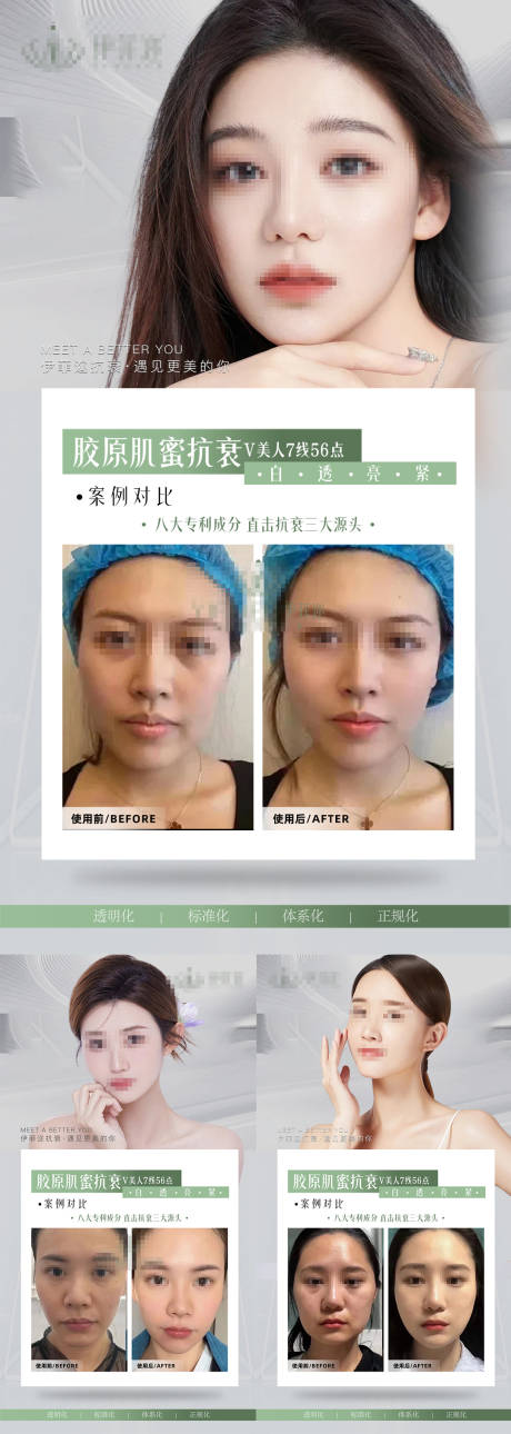 编号：89840024105225713【享设计】源文件下载-医美逆龄全脸抗衰V脸打造案例对比海报