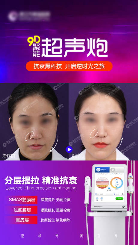 源文件下载【超声炮案例海报】编号：84080023852959677