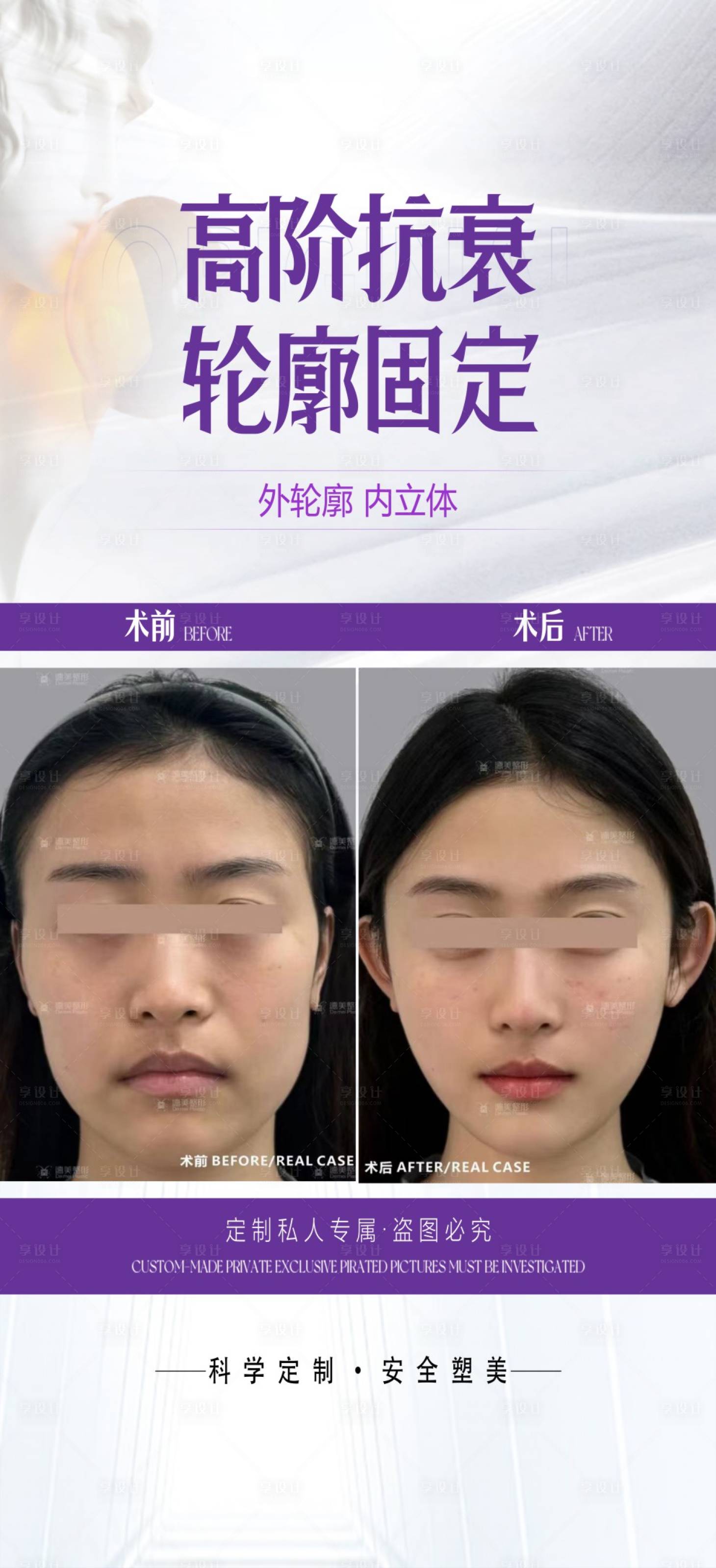 源文件下載【享設(shè)計】搜索編號：98950024039838663【醫(yī)美抗衰案例海報】