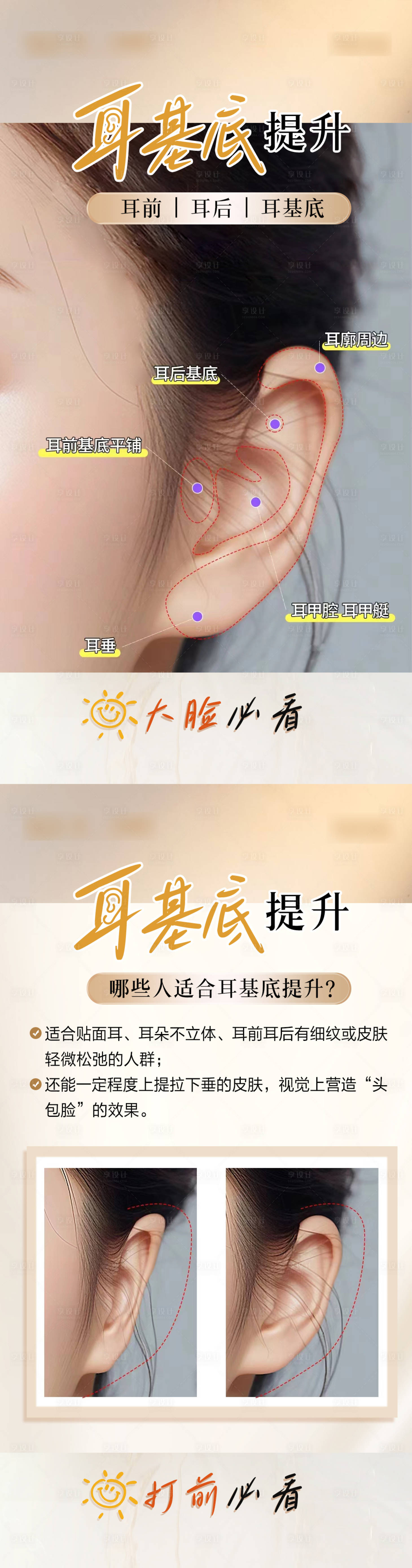 源文件下載【享設計】搜索編號：30330023946602216【耳基底提升 】