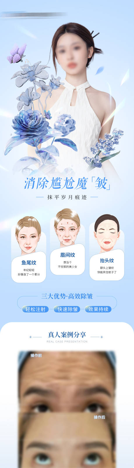 源文件下载【享设计】搜索编号：28080023878786196【医美除皱针案例海报】