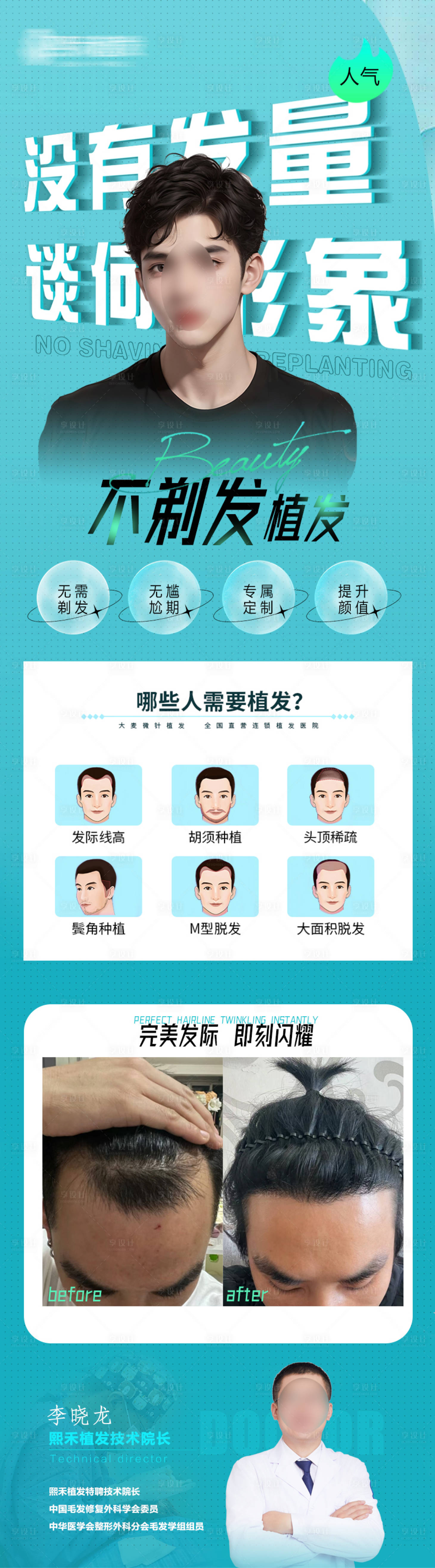 源文件下载【植发男士不剃发海报】编号：85610023749379116