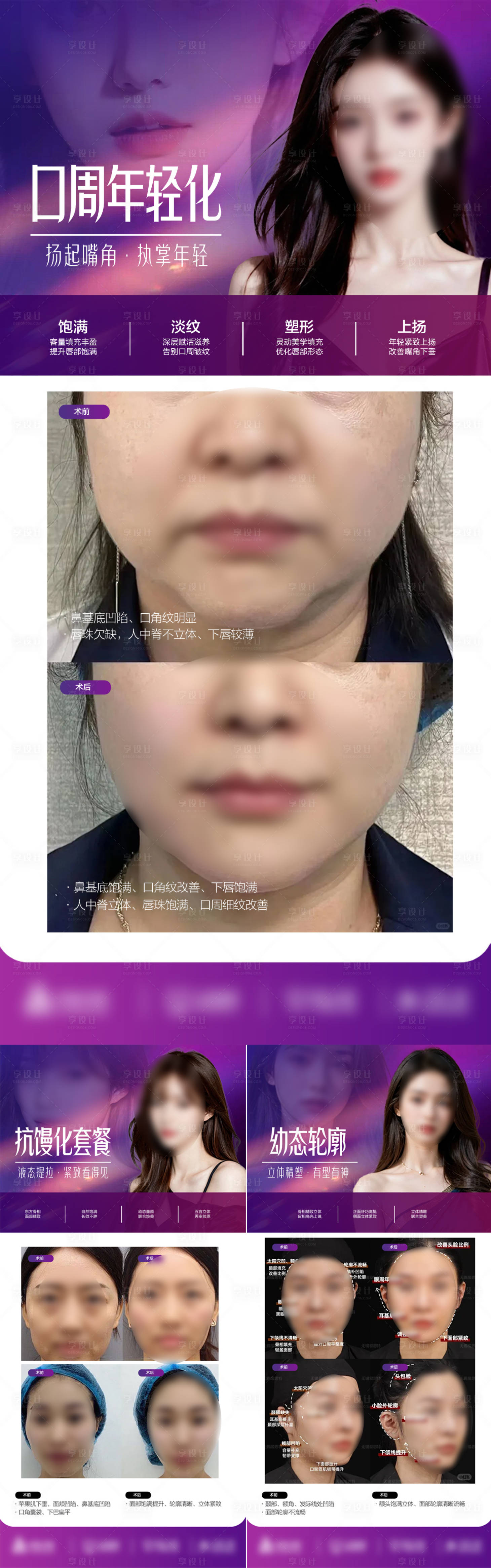 源文件下载【医美海报设计】编号：76990023751292048