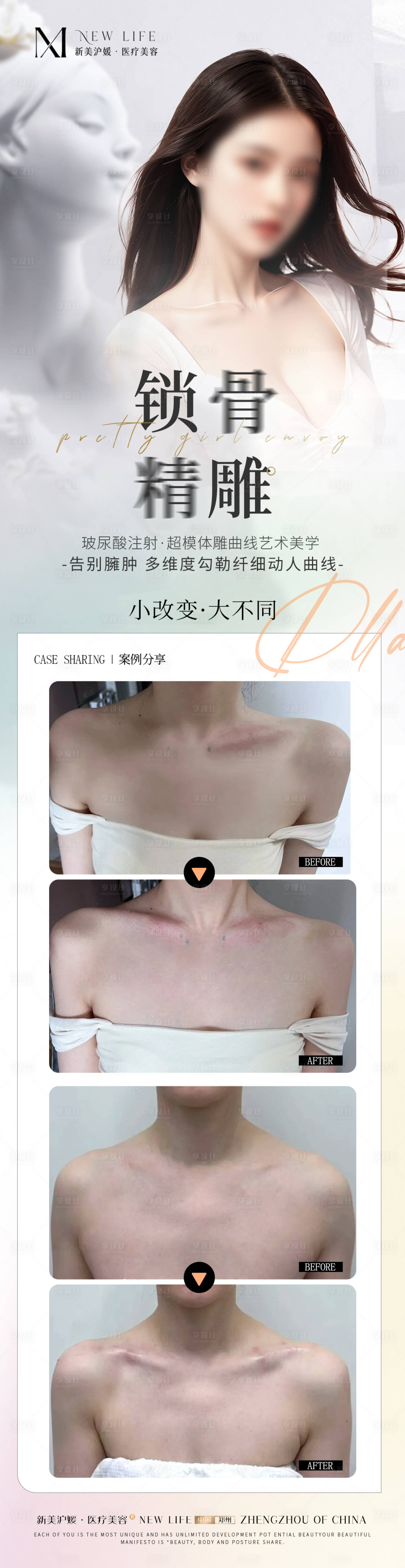 源文件下载【享设计】搜索编号：47610024142139419【医美针剂玻尿酸长图】
