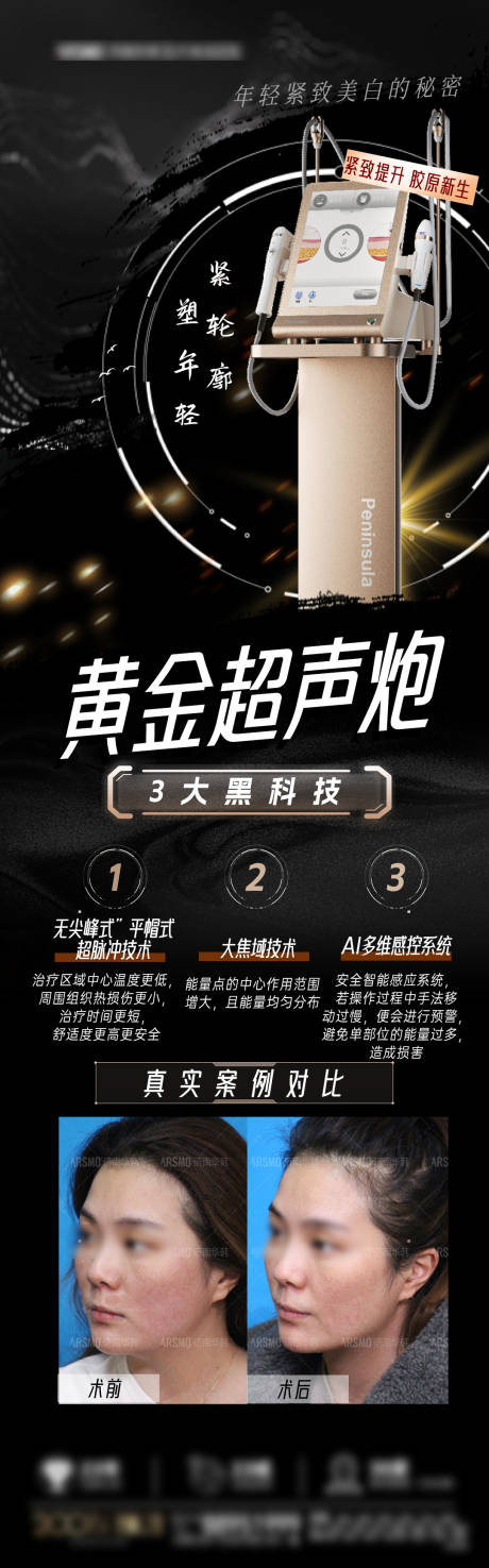 源文件下載【享設計】搜索編號：55320023770446205【超聲炮案例海報】