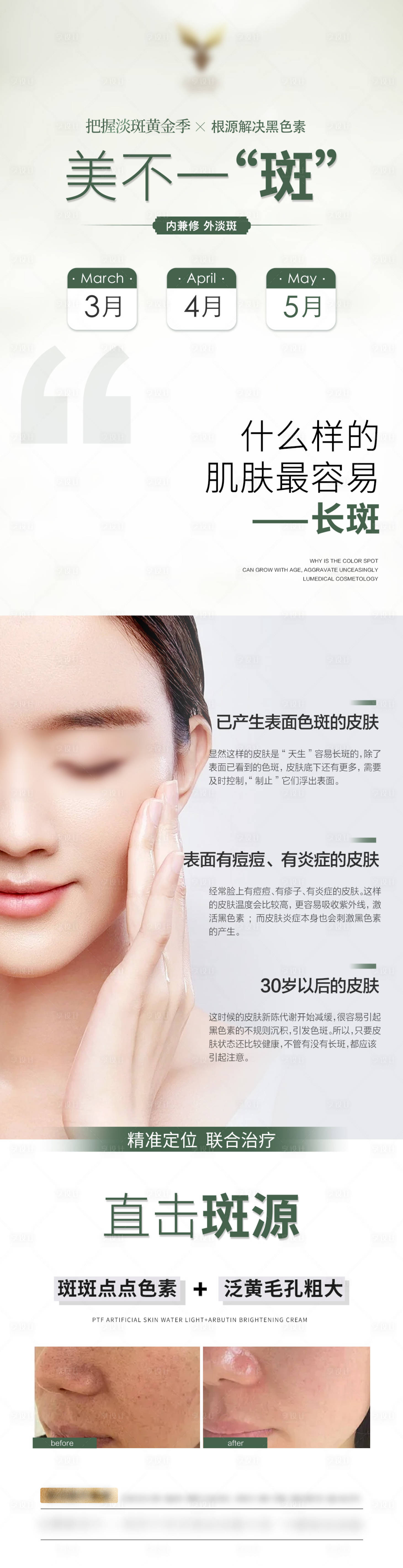 源文件下载【享设计】搜索编号：63790023650845767【夏季淡斑护肤海报】
