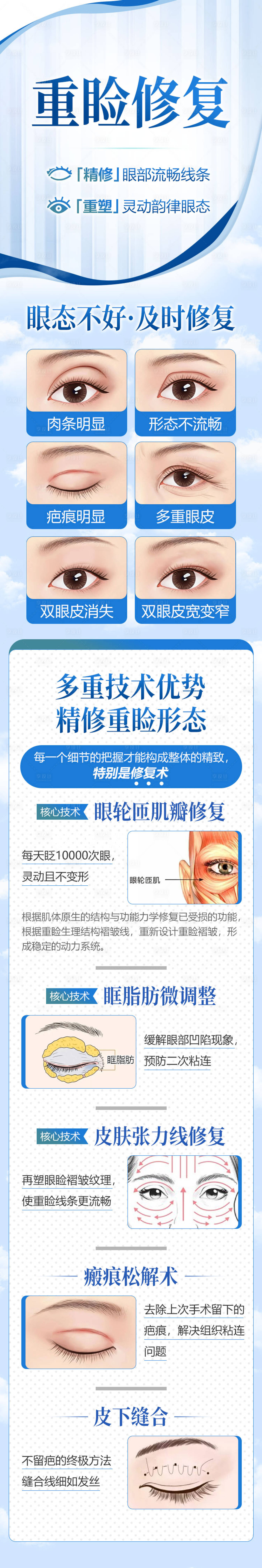 源文件下載【享設計】搜索編號：63960024140995733【雙眼皮修復技術長圖】