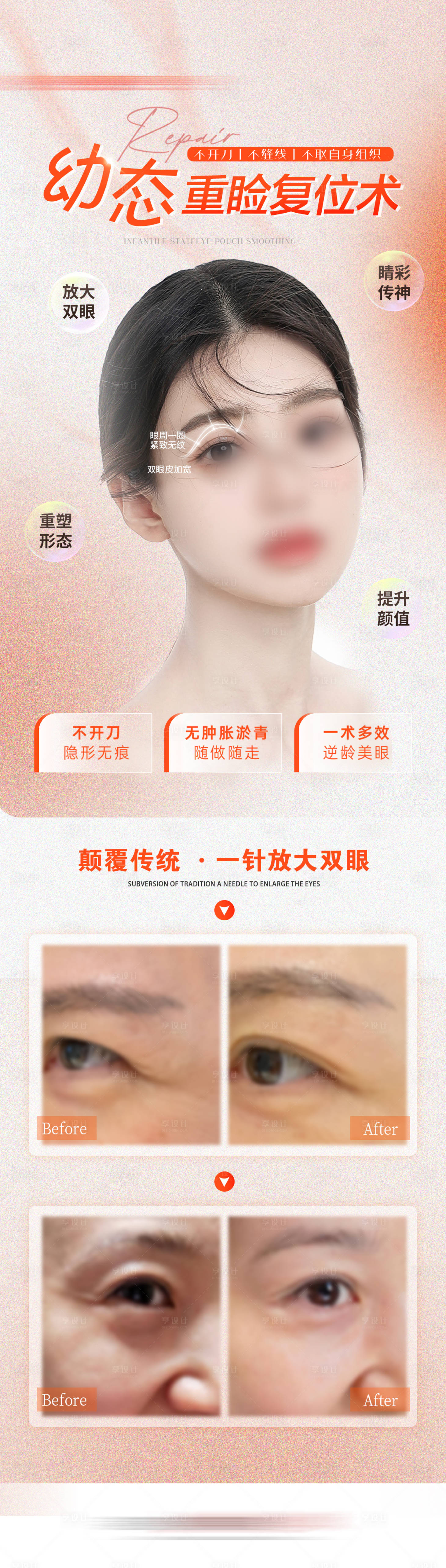 源文件下載【享設(shè)計(jì)】搜索編號(hào)：11140023689515177【醫(yī)美幼態(tài)重瞼復(fù)位術(shù)長圖】