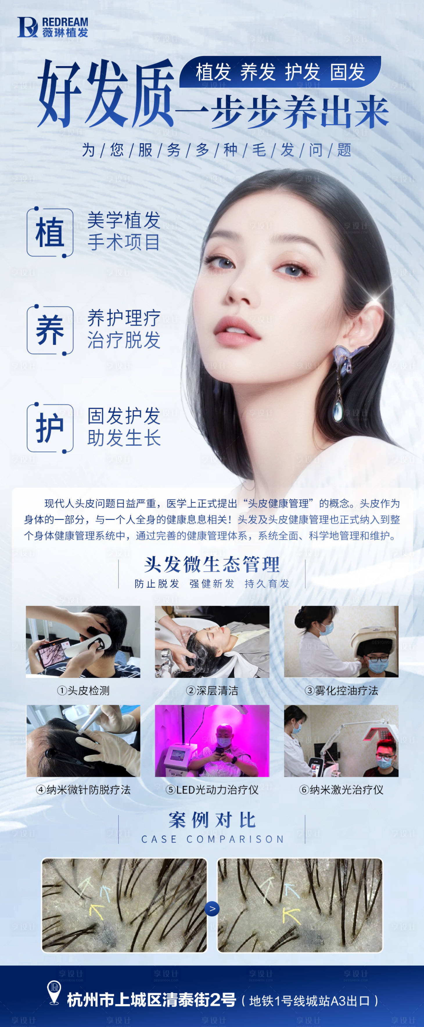 源文件下载【享设计】搜索编号：75040024110293557【植发品牌案例图】