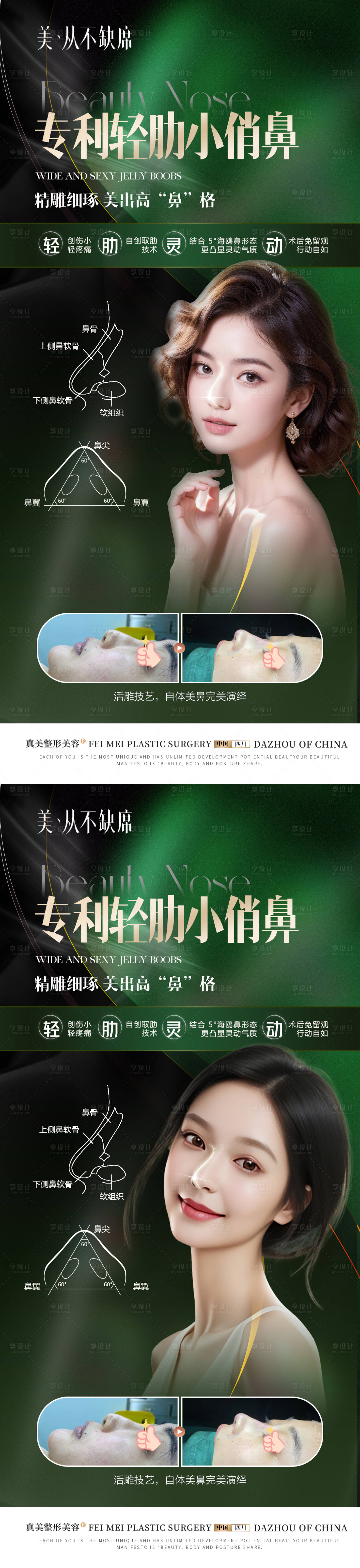源文件下載【醫(yī)美隆鼻案例海報】編號：25880024471976297