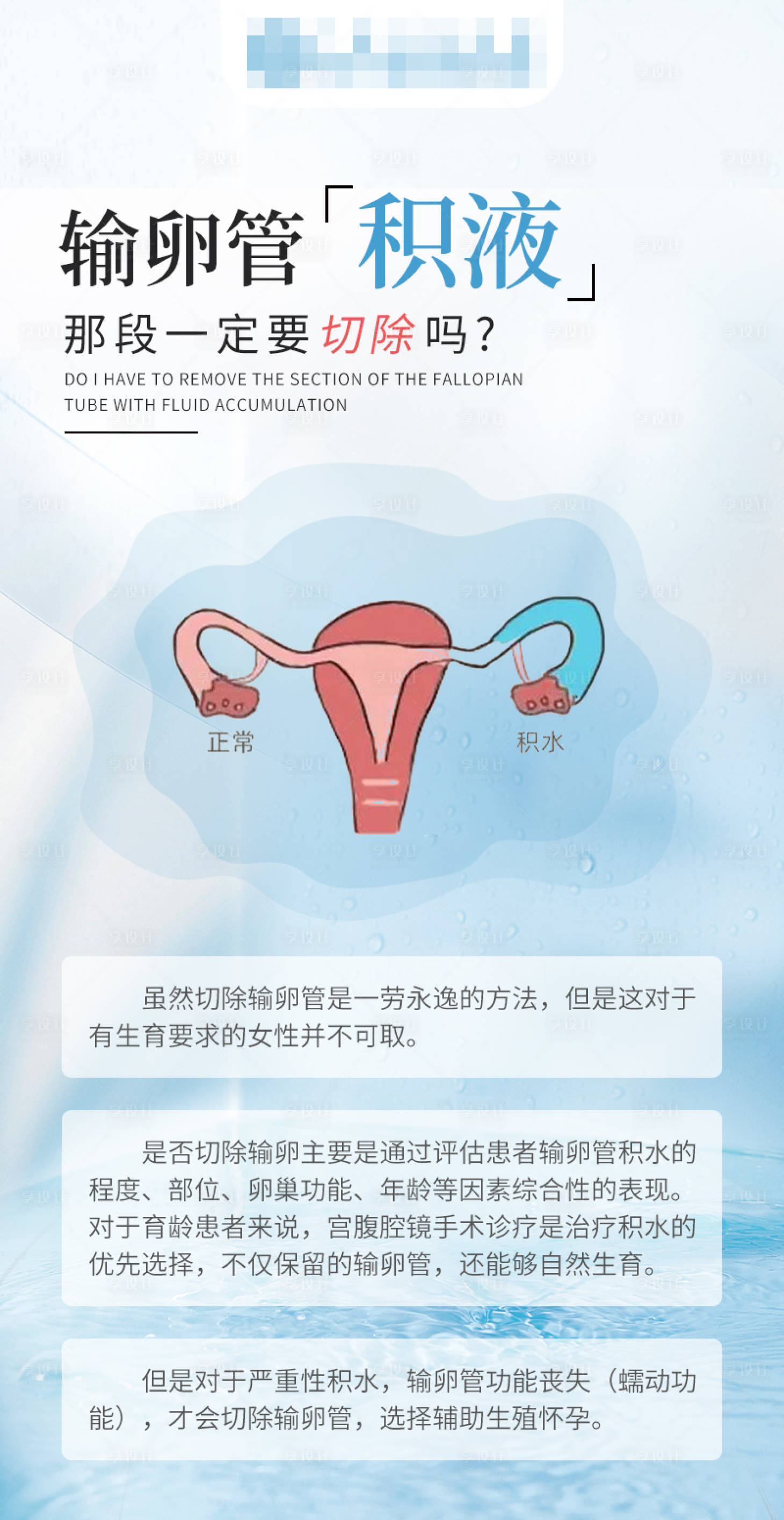 源文件下载【享设计】搜索编号：27100024363714708【输卵管积液那段一定要切除吗】
