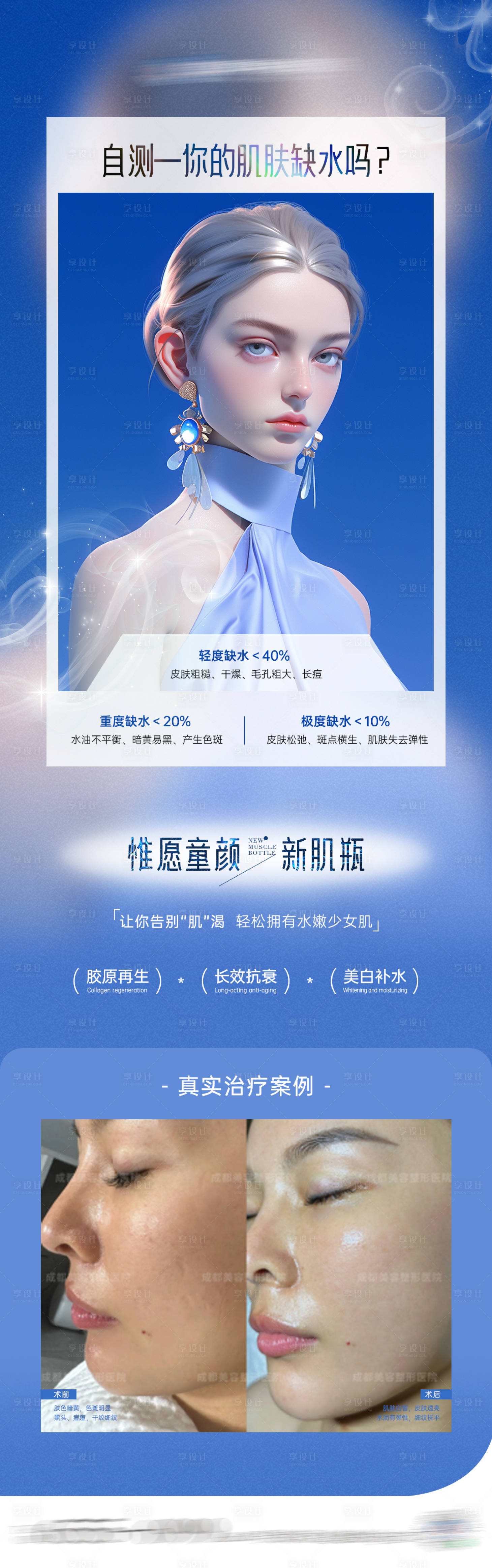 源文件下載【享設(shè)計】搜索編號：29110024311656908【醫(yī)美項目案例海報】