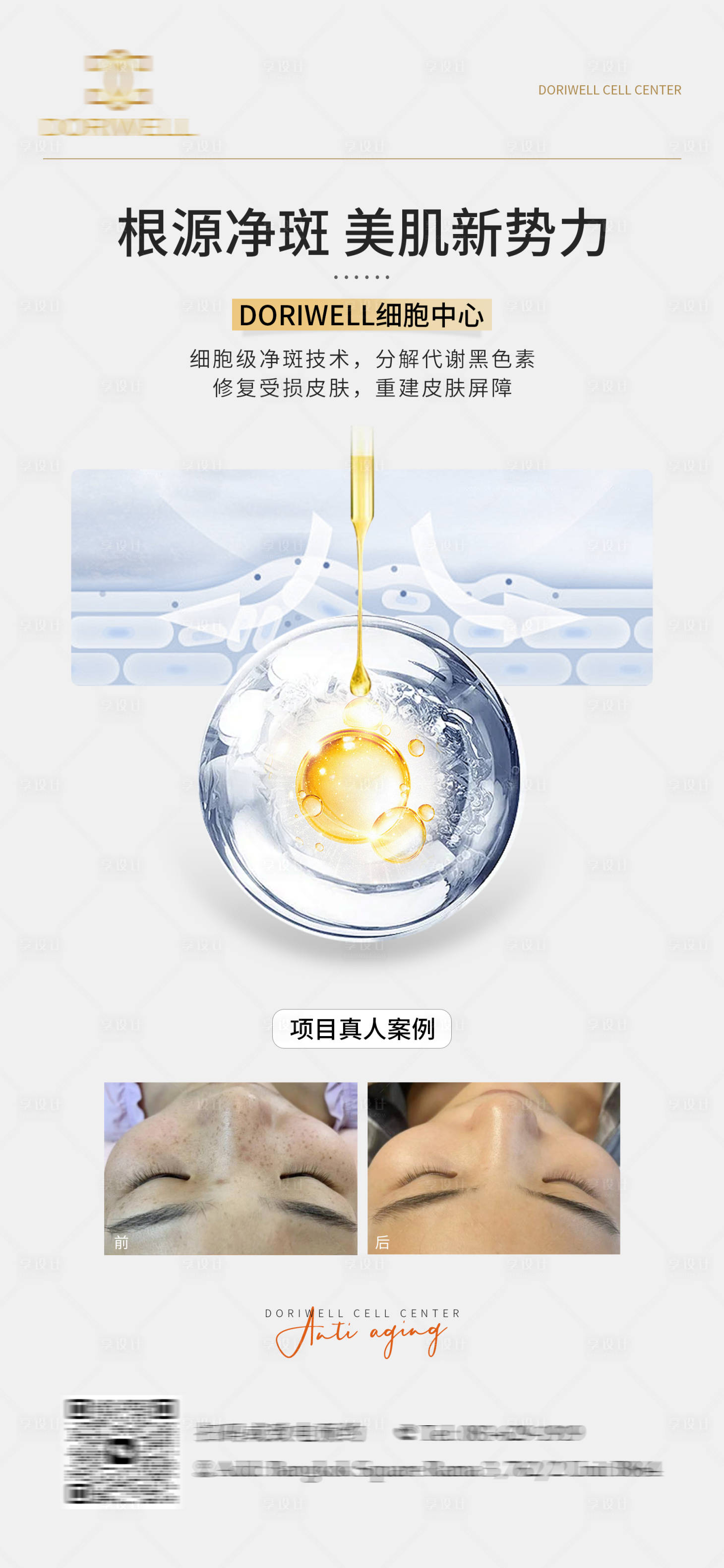 源文件下載【享設(shè)計(jì)】搜索編號(hào)：88430024608243665【醫(yī)美案例海報(bào)】