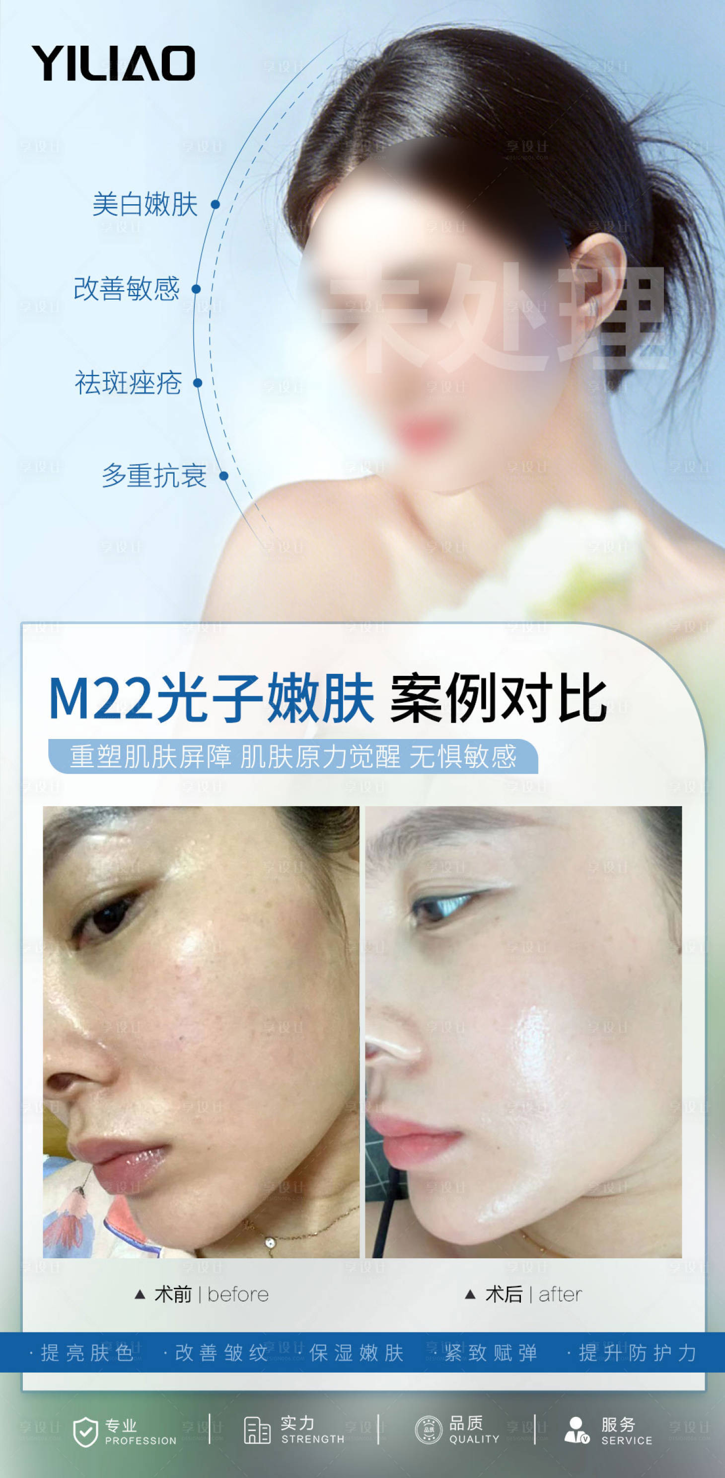 源文件下載【享設計】搜索編號：41430024281289903【光子嫩膚案例對比】