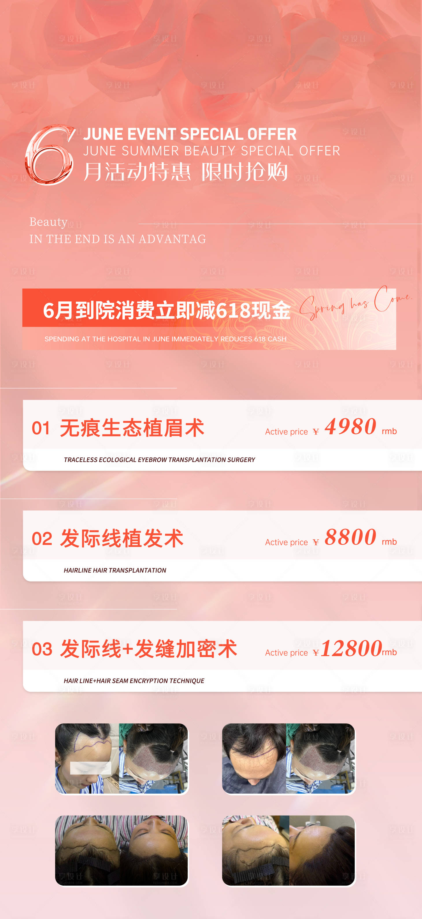 源文件下载【享设计】搜索编号：47060024309679575【医美6月活动海报】