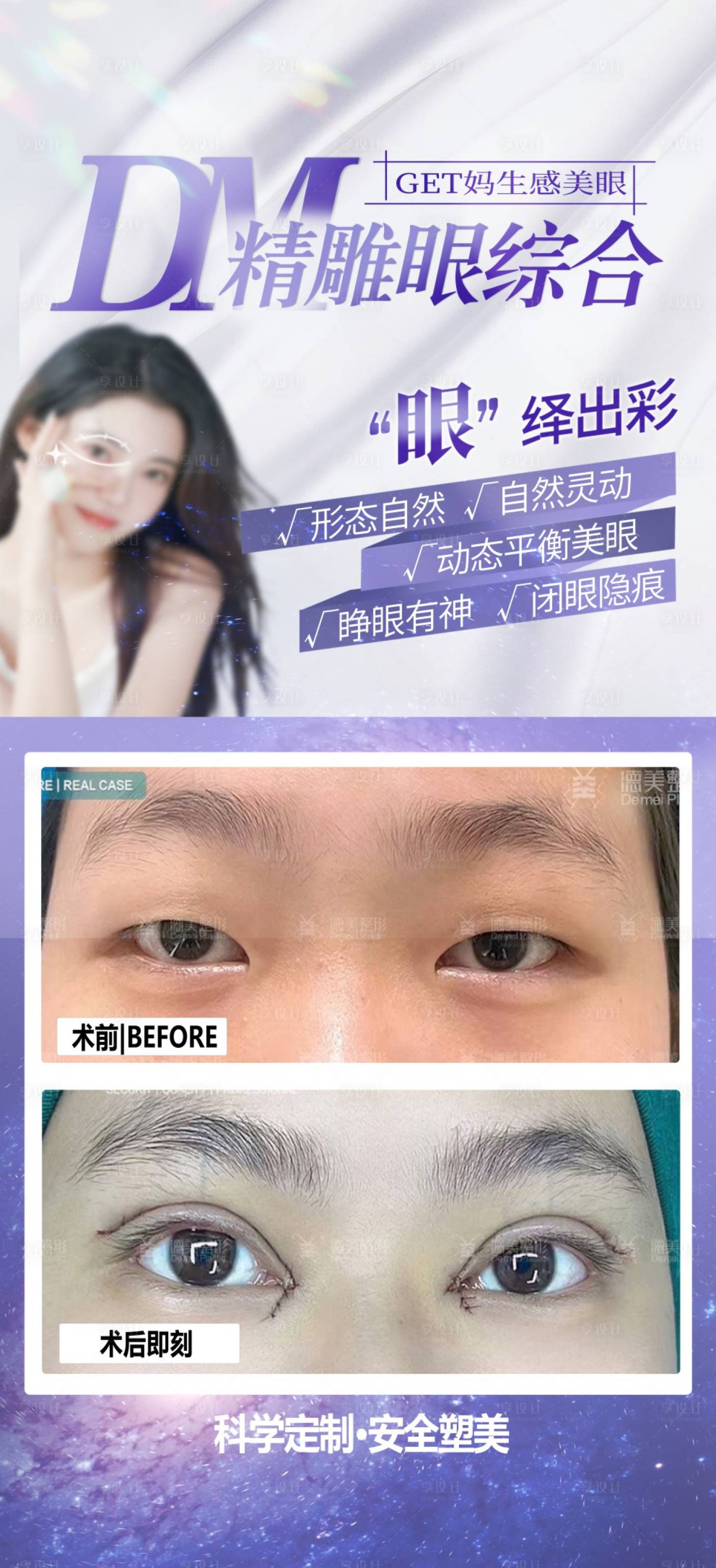 源文件下載【眼綜合案例對比海報】編號：40070024475974993