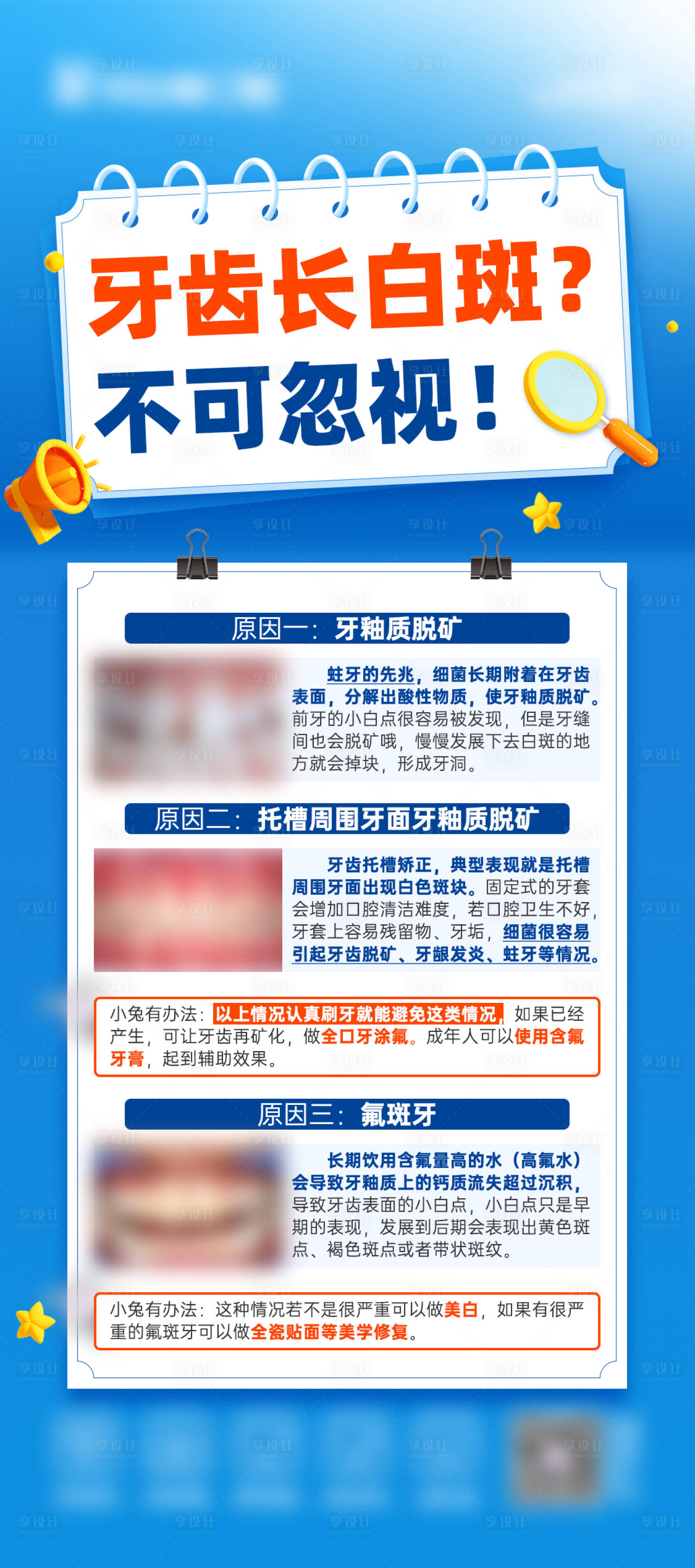 源文件下載【享設計】搜索編號：84890024722116712【牙齒長白斑？ 】