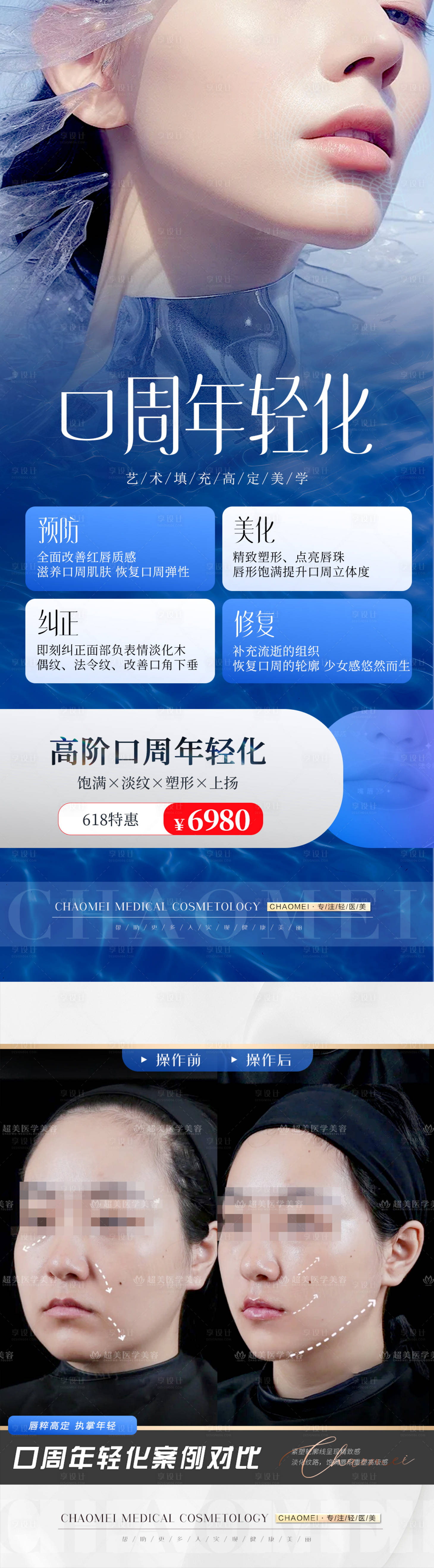 源文件下載【享設計】搜索編號：54540024316383265【醫美口周年輕化長圖海報】