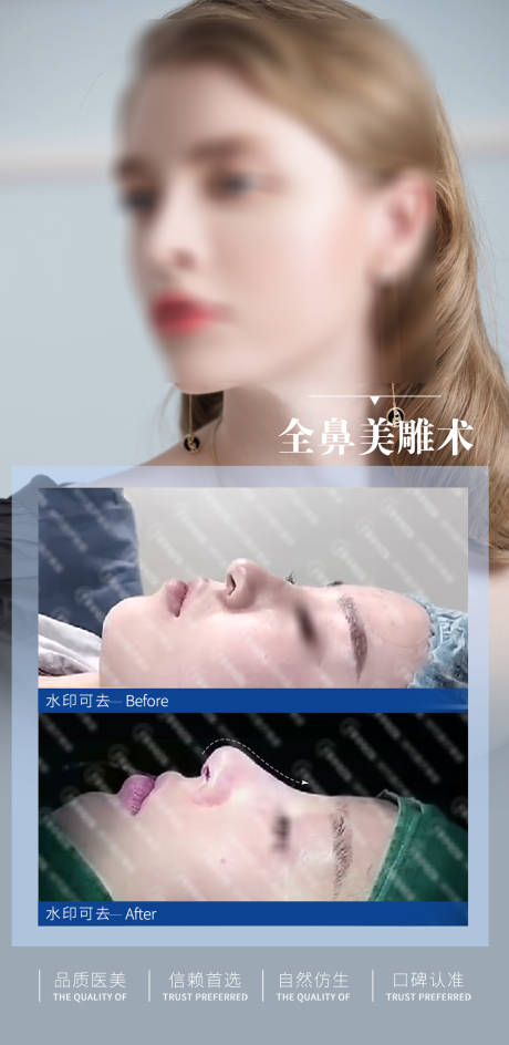 源文件下载【隆鼻医美案例宣传海报】编号：85180024848533647