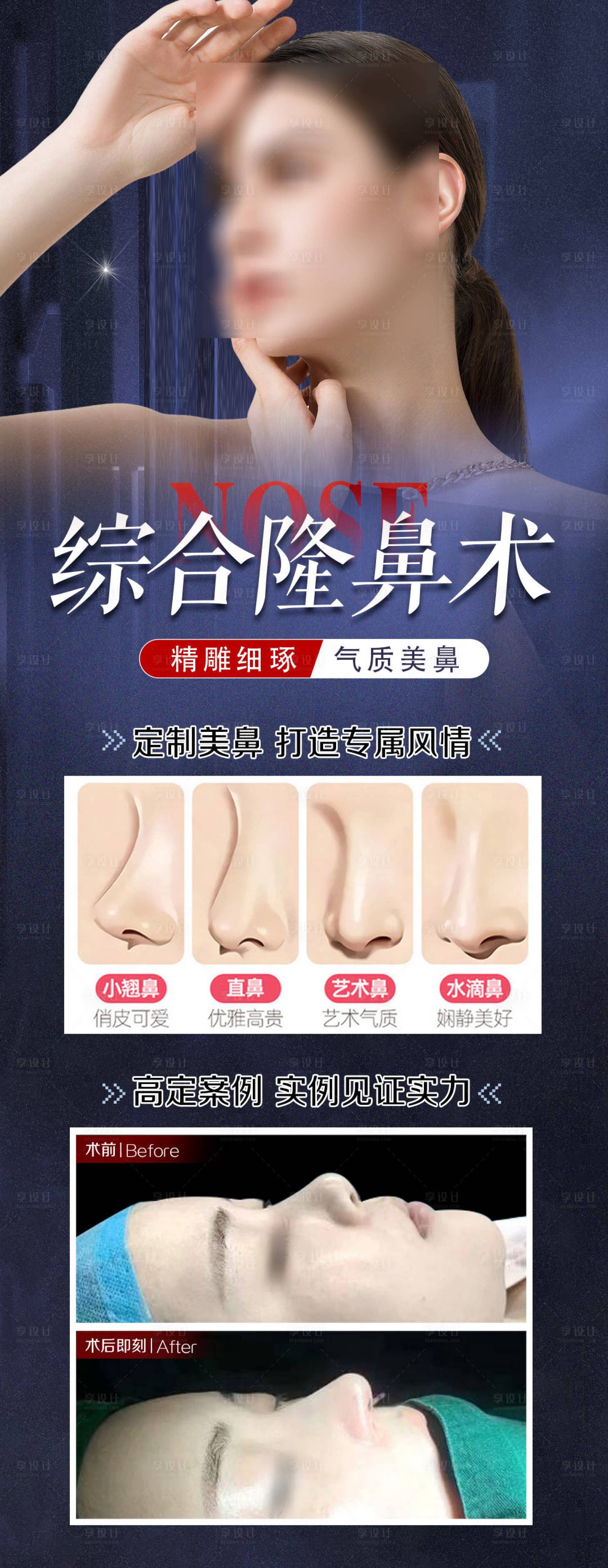 源文件下載【享設計】搜索編號：84520024433847127【隆鼻真人案例醫美整形項目海報】
