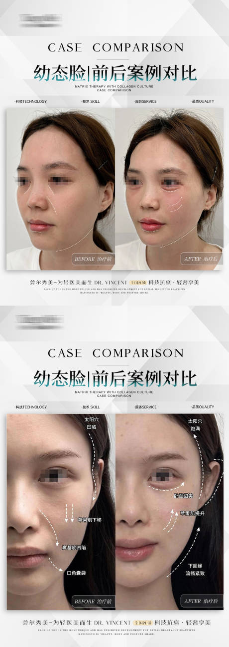 源文件下载【医美案例海报】编号：94280024712693771