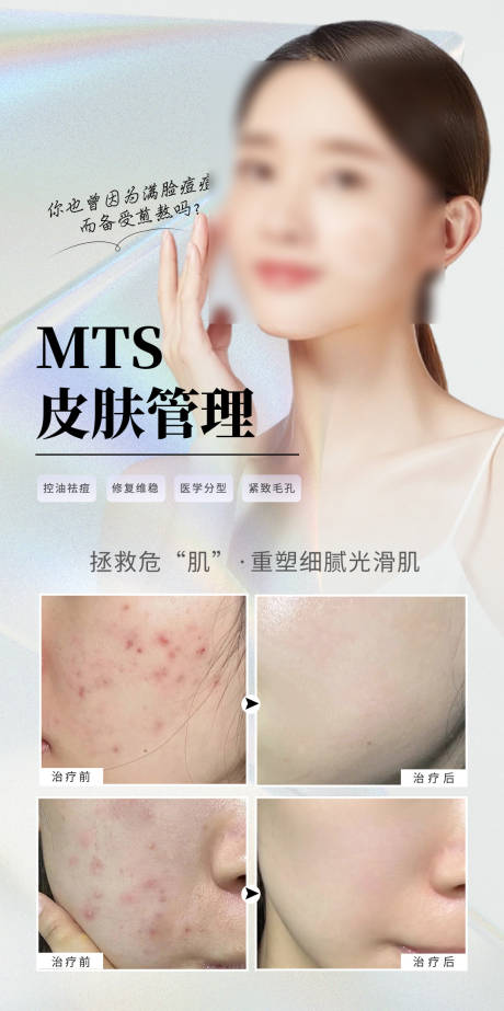 源文件下载【享设计】搜索编号：71620024544321378【医美皮肤管理海报】