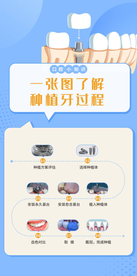 源文件下载【口腔种植科普海报】编号：60290024738297588