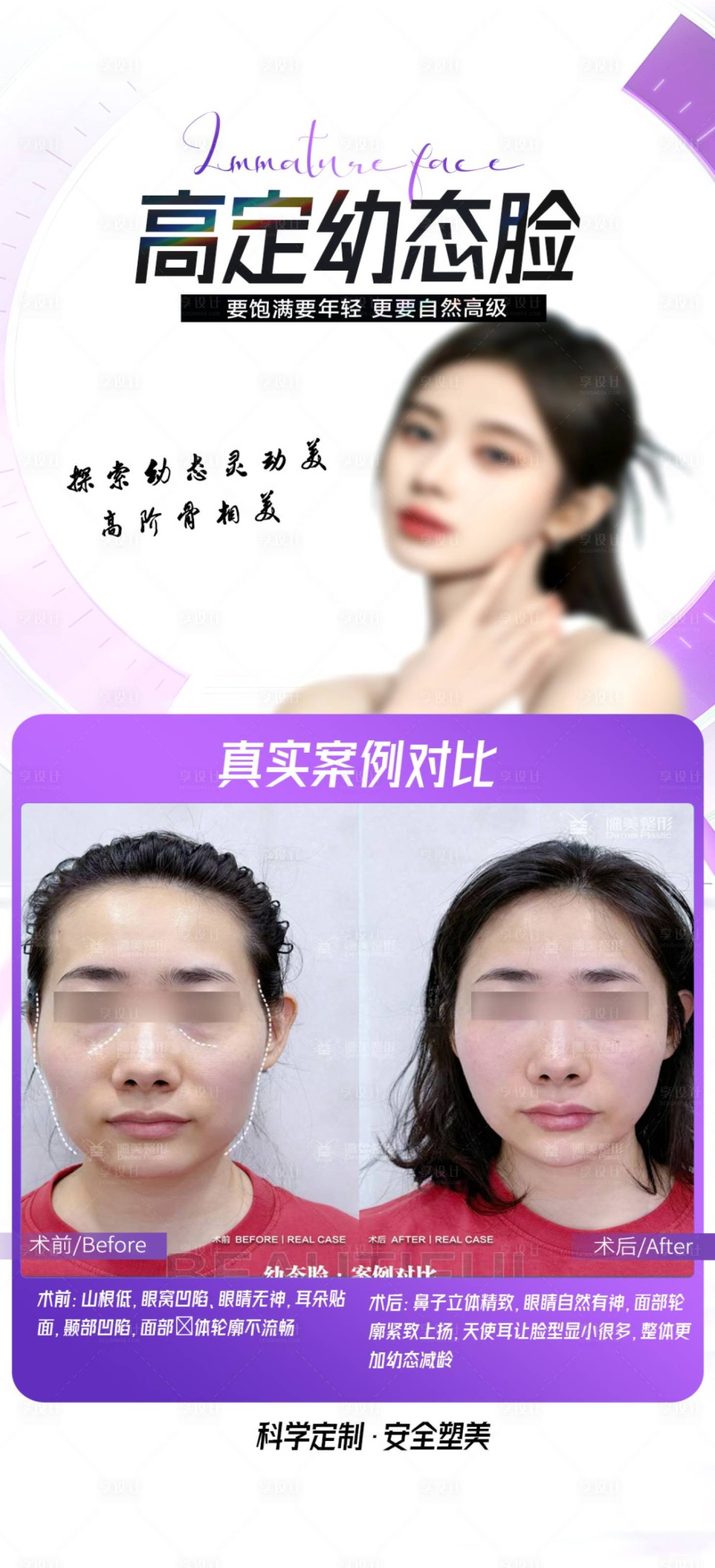 源文件下载【幼态脸案例海报】编号：67380024750561558