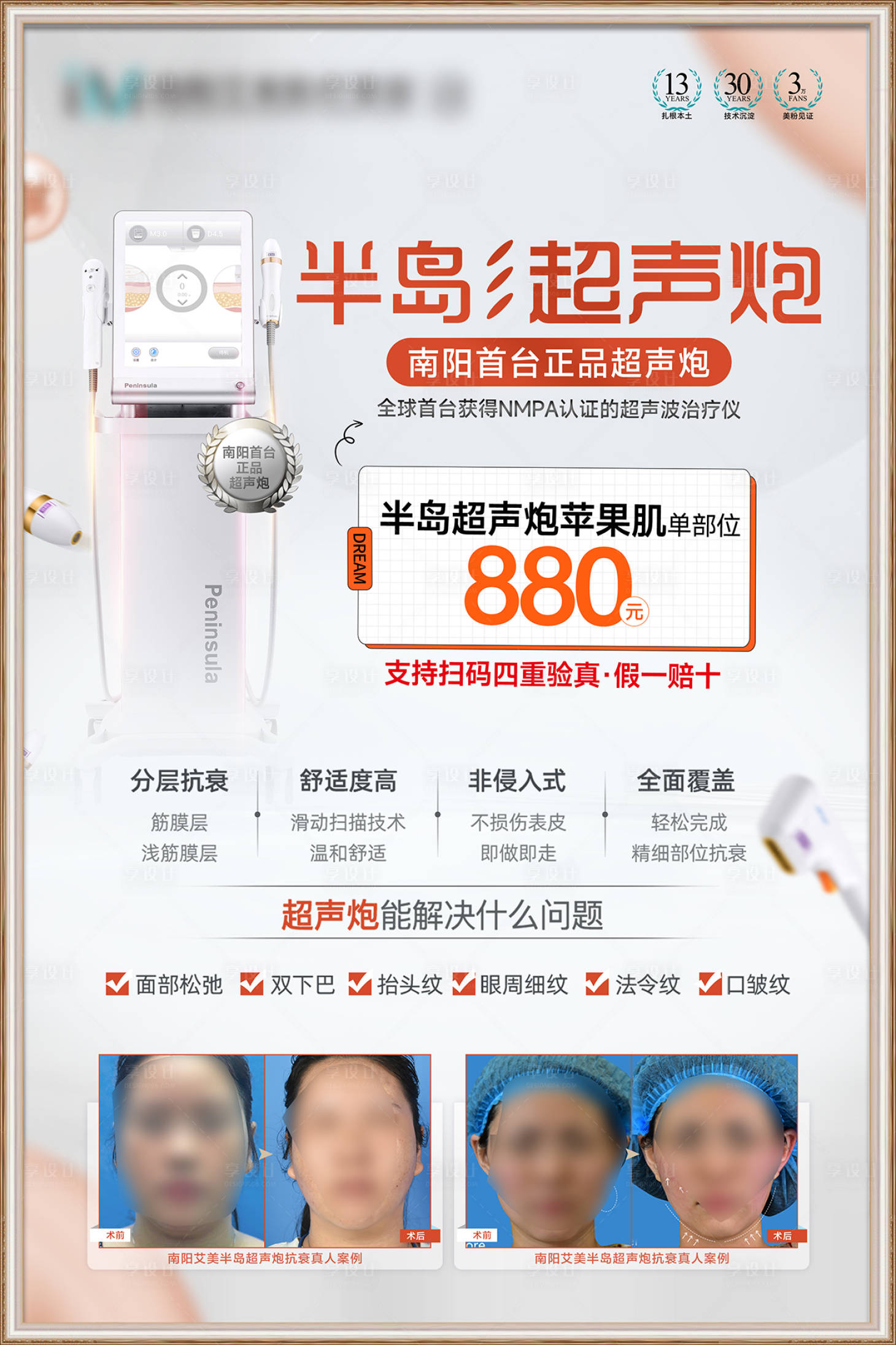 源文件下載【享設計】搜索編號：94440024697297948【超聲炮臺卡】