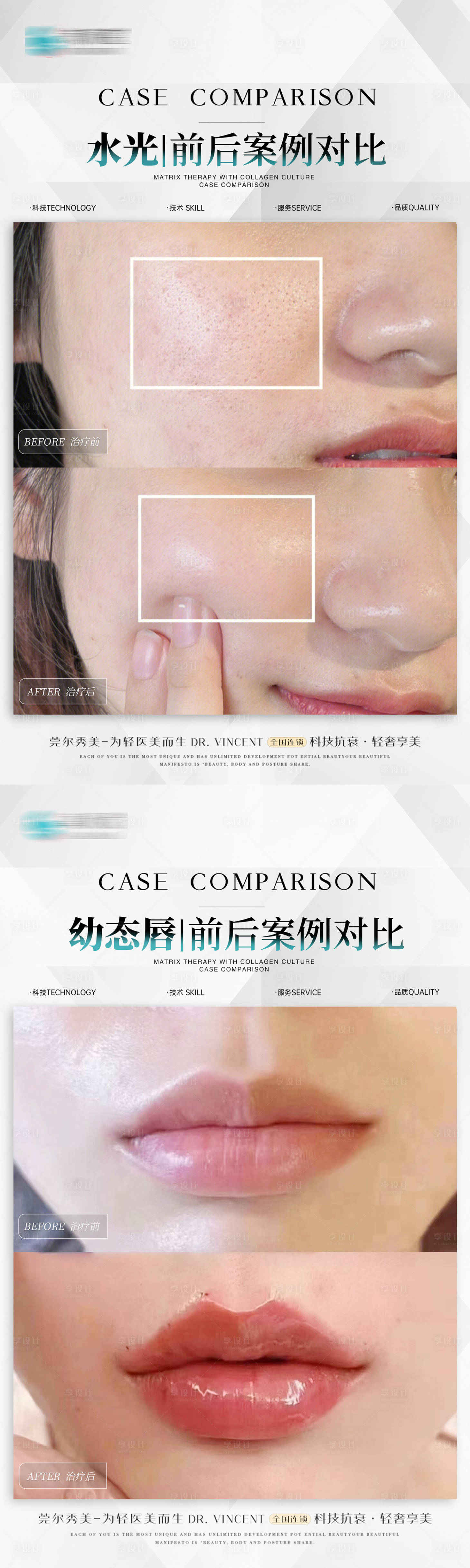 源文件下載【享設計】搜索編號：62880024807954716【醫美案例海報】
