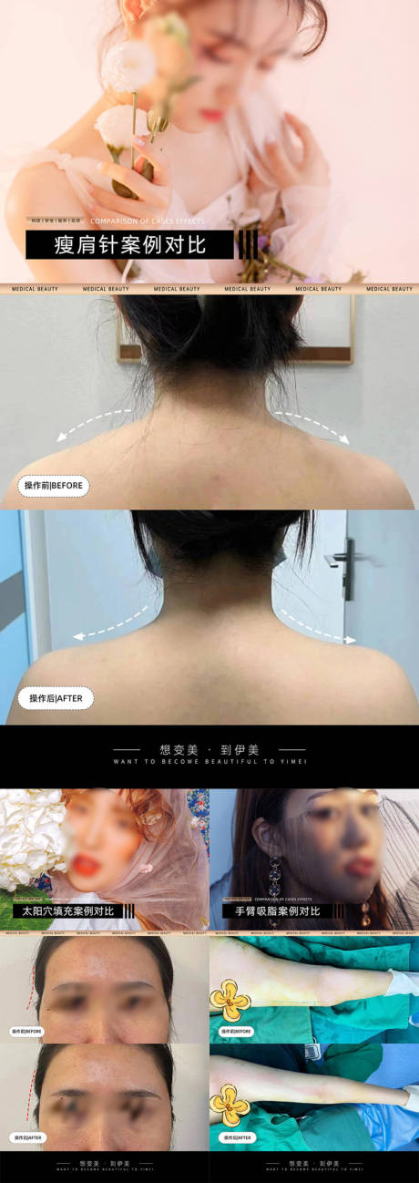 源文件下载【医美案例对比模板】编号：63770024280464456