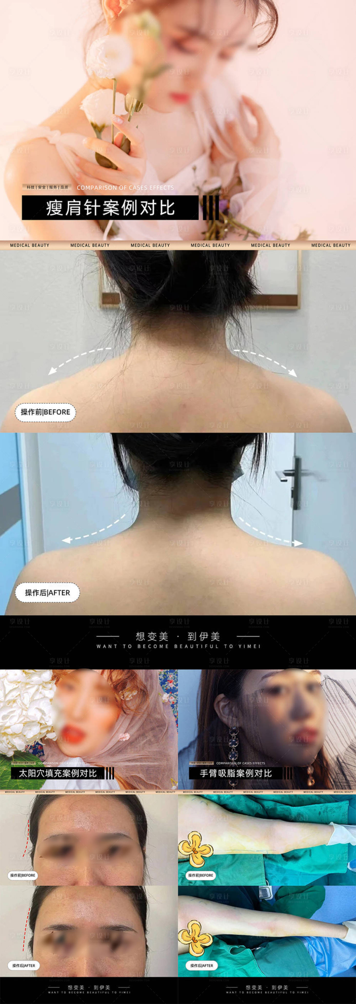 源文件下載【享設(shè)計(jì)】搜索編號：63770024280464456【醫(yī)美案例對比模板】