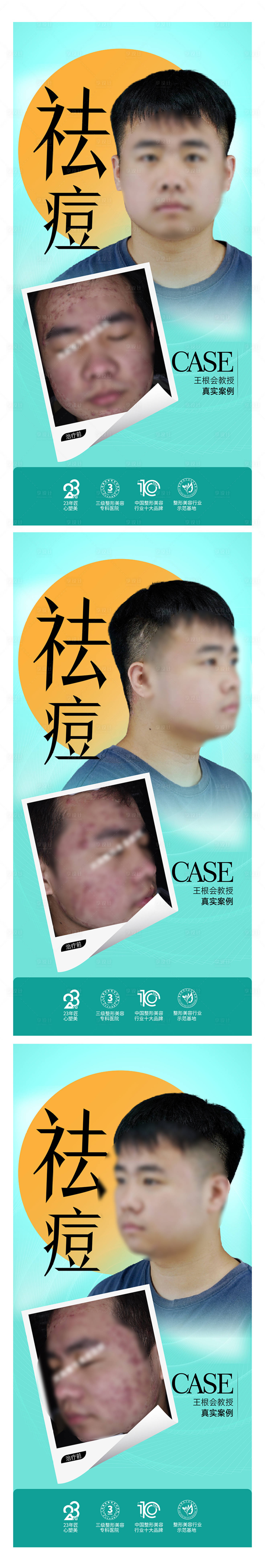 源文件下载【享设计】搜索编号：32820024323233705【整形美容海报 】