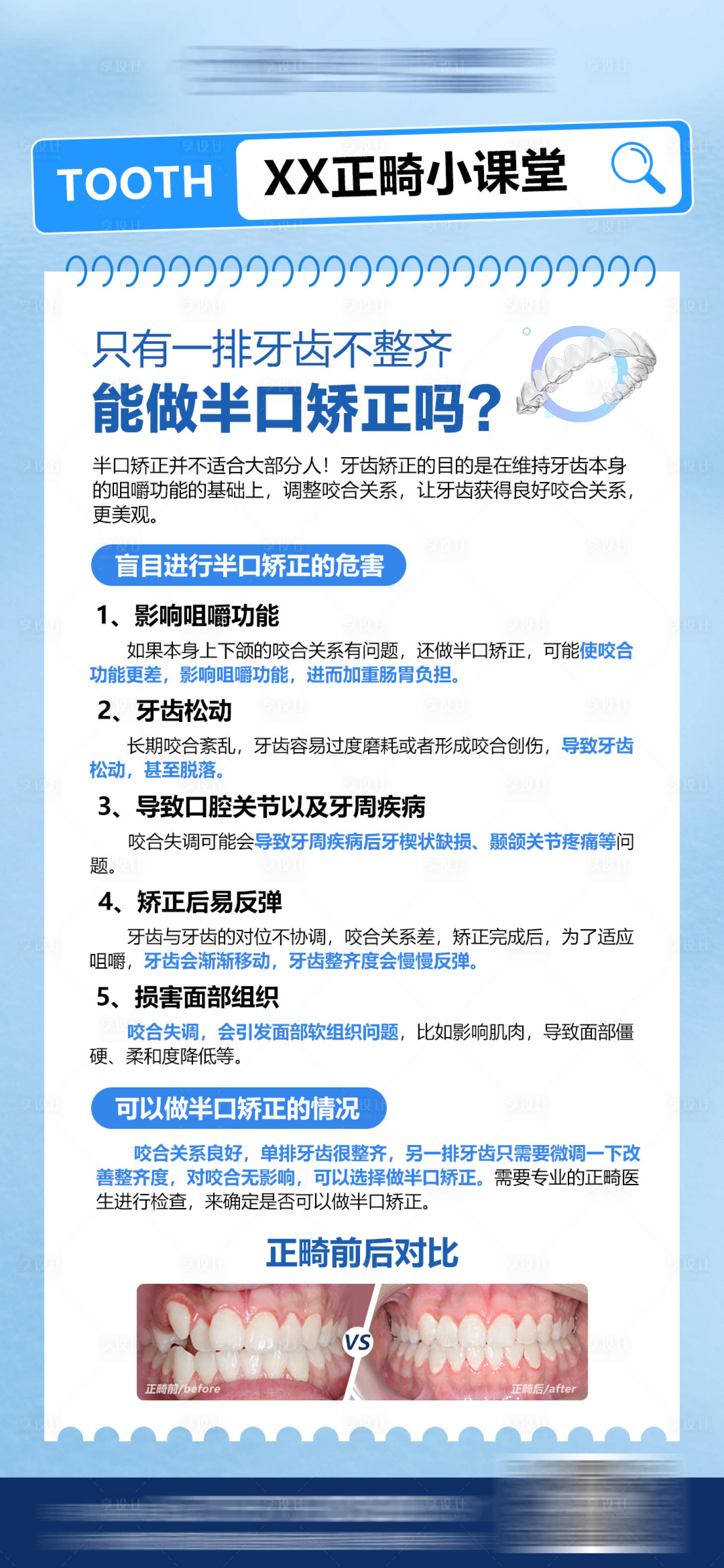 源文件下載【享設計】搜索編號：28380024736981770【口腔正畸科普】