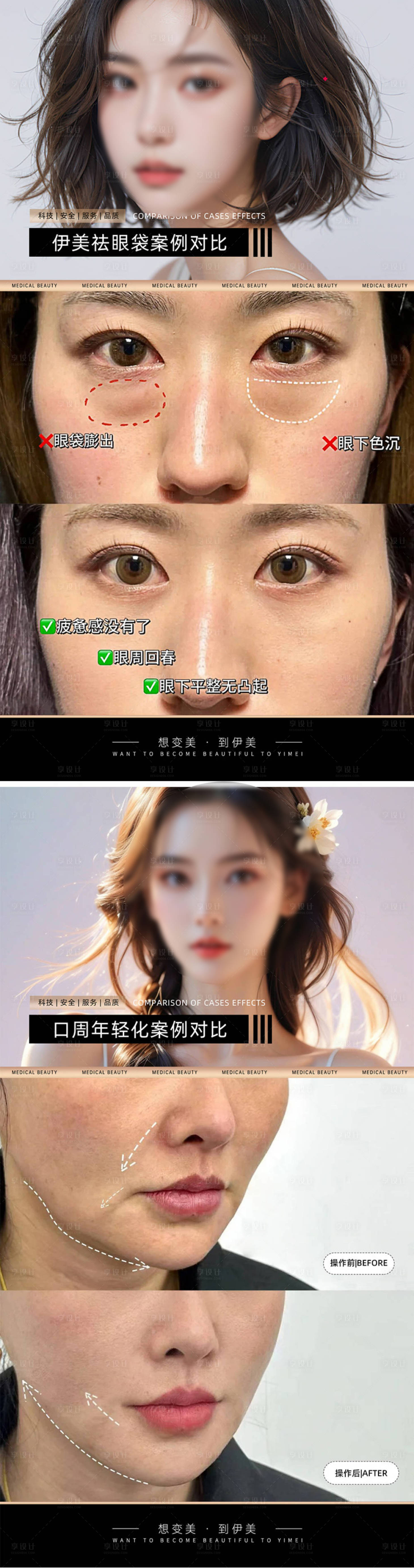 源文件下载【享设计】搜索编号：31790024647446244【医美案例对比海报】