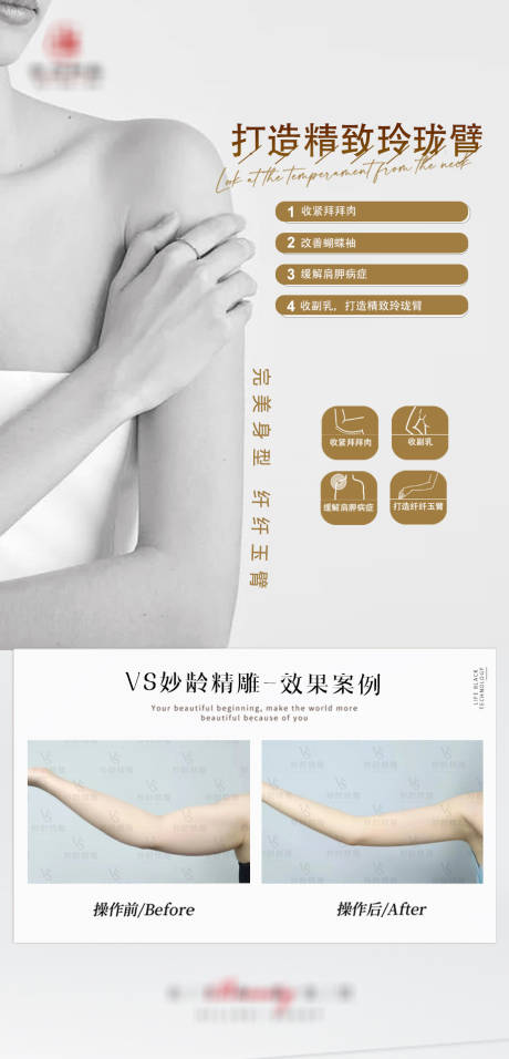 玲珑臂