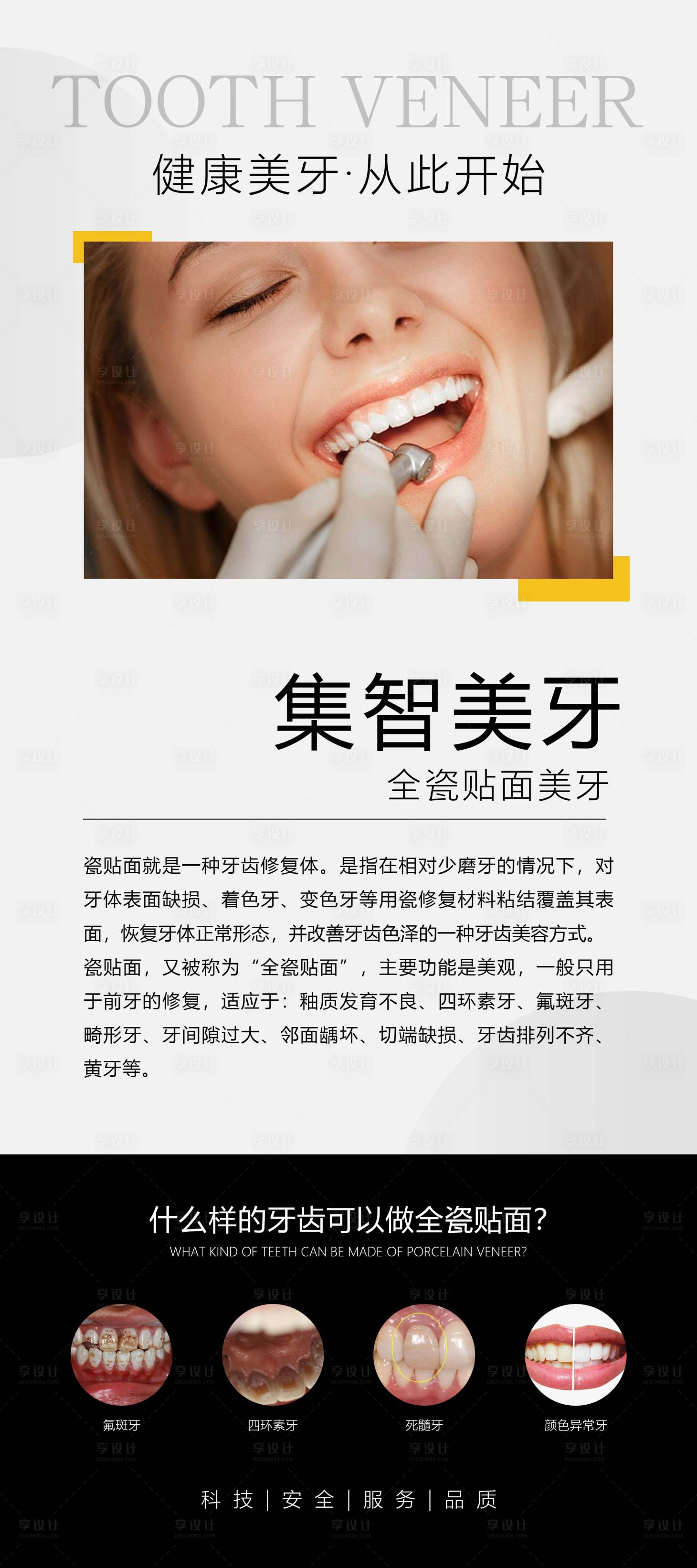 源文件下载【享设计】搜索编号：32240024535905112【牙齿贴面展架】