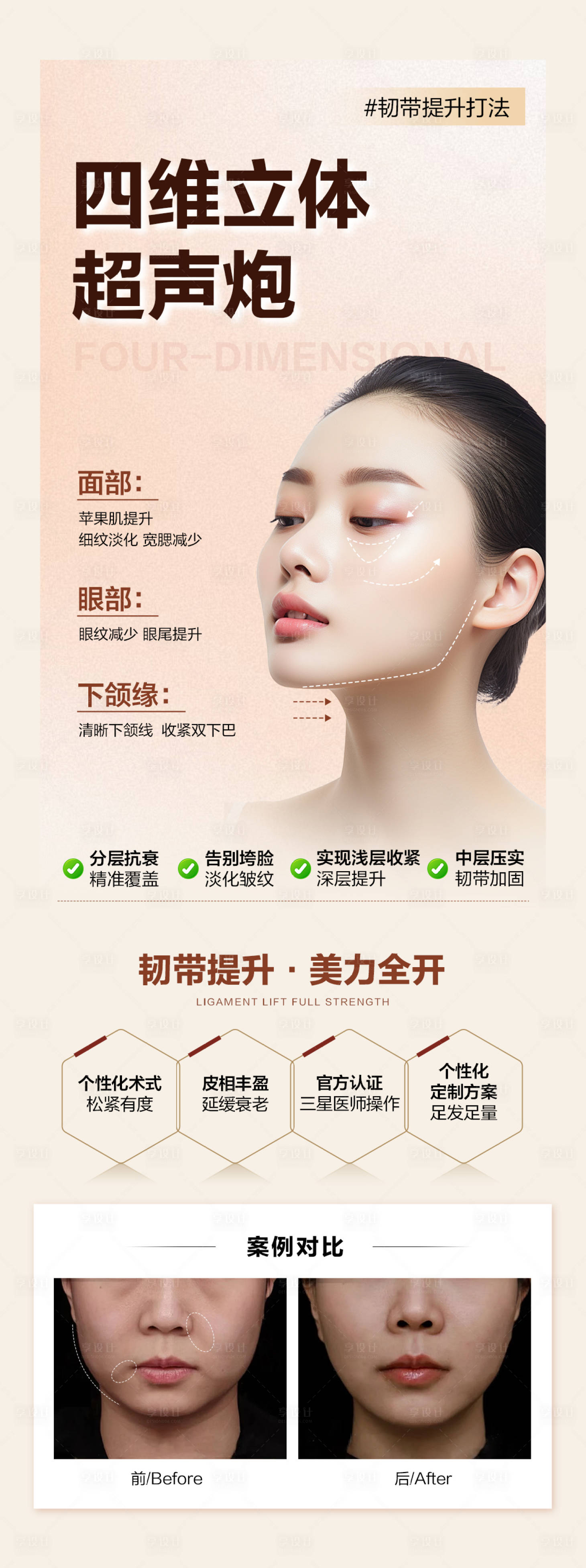 源文件下載【享設計】搜索編號：63830024750669020【超聲炮海報】
