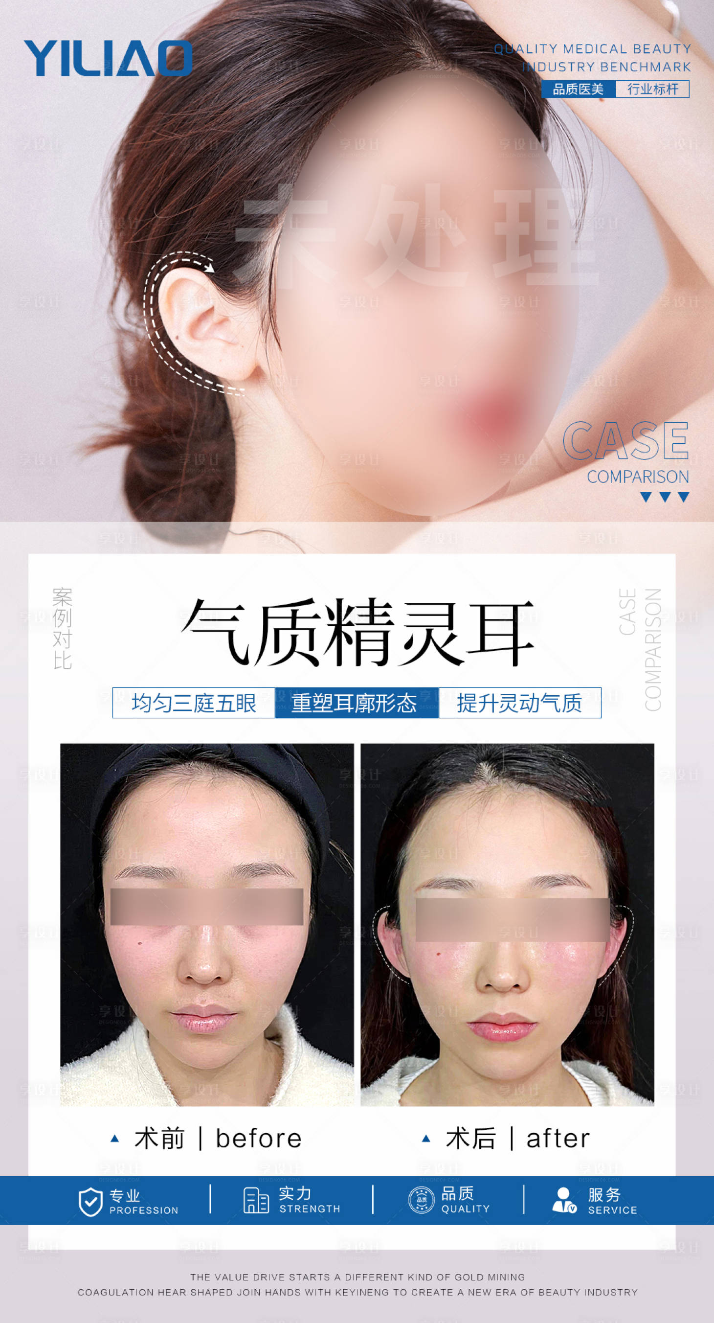 源文件下载【享设计】搜索编号：80680024316266079【气质精灵耳案例对比海报】