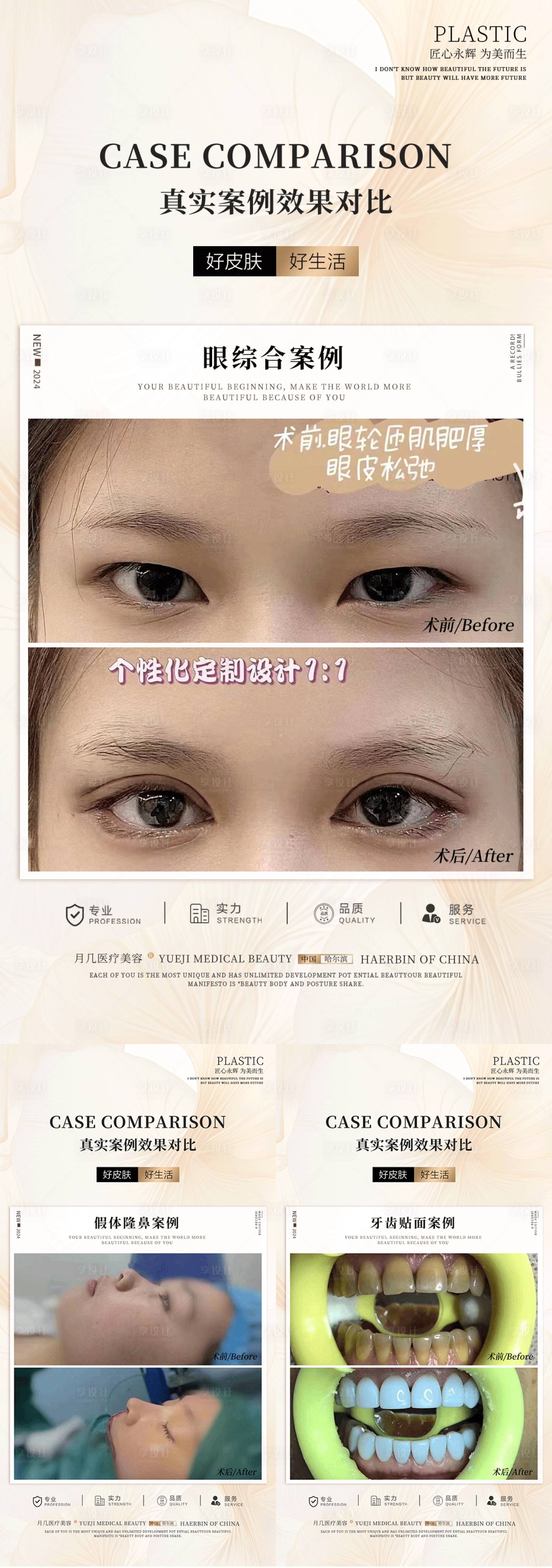 源文件下载【美容口腔案例海报】编号：97640024265393168