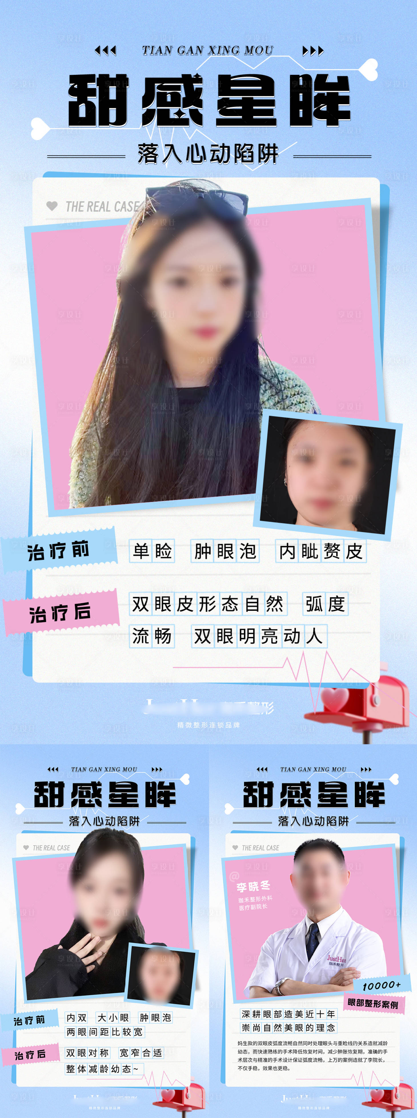 源文件下載【享設計】搜索編號：47610024669272972【雙眼皮案例對比海報】