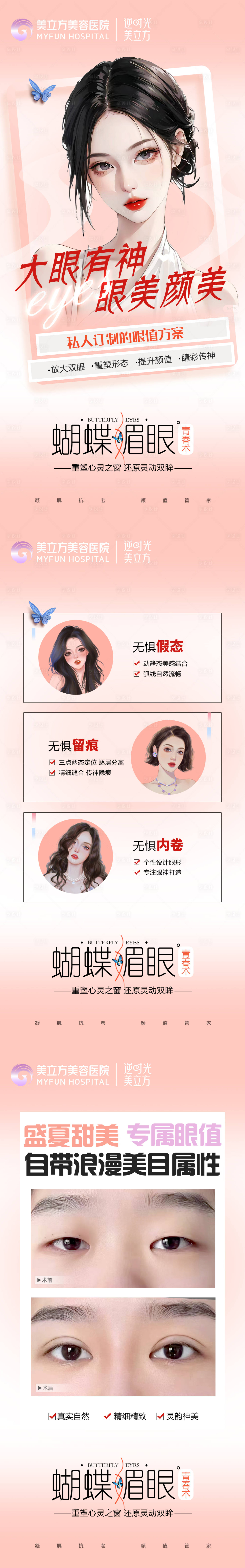 源文件下载【医美整形双眼皮案例对比双眼皮特点】编号：31930024556599913