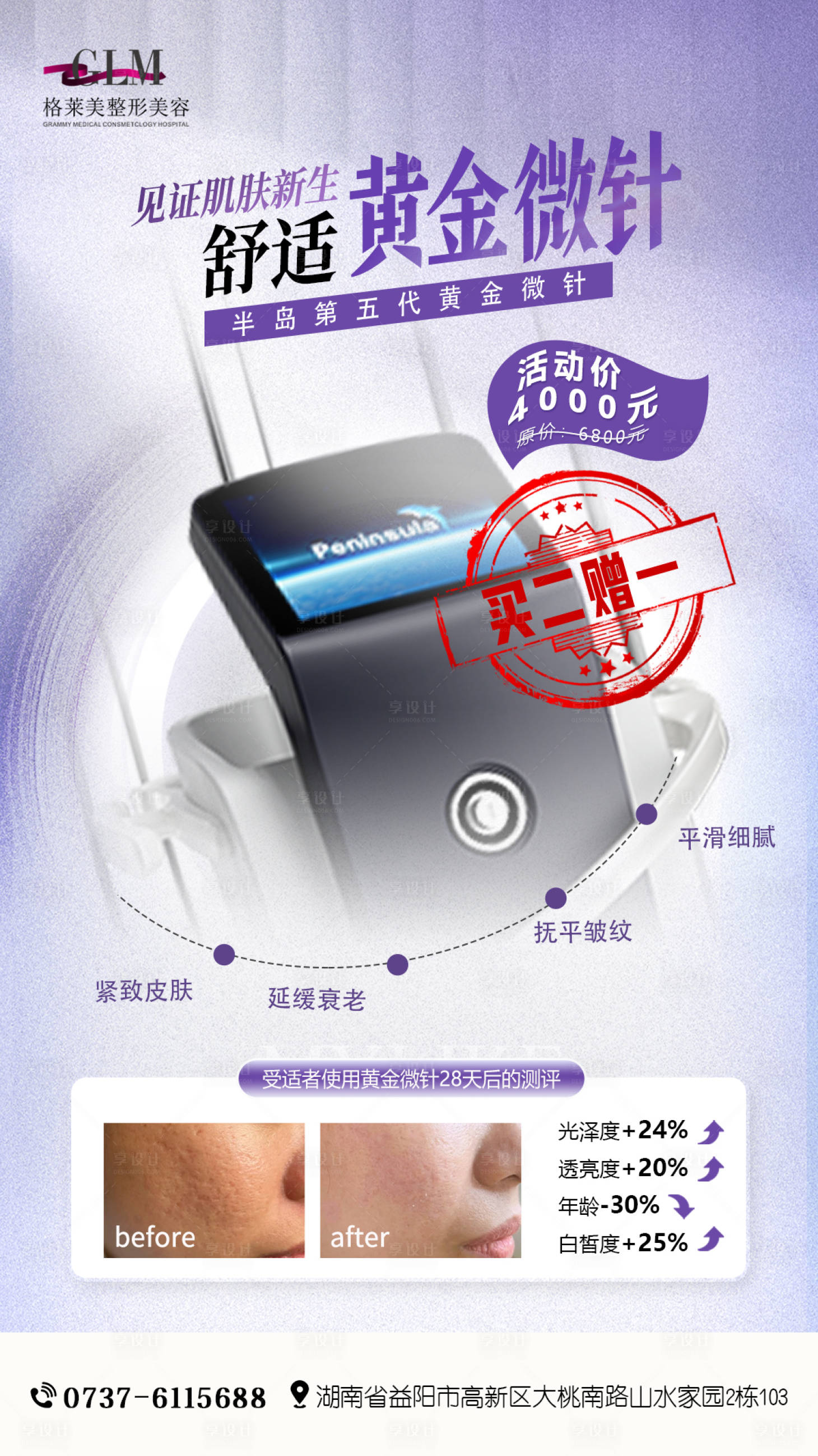 源文件下载【享设计】搜索编号：52880024393118463【黄金微针海报】