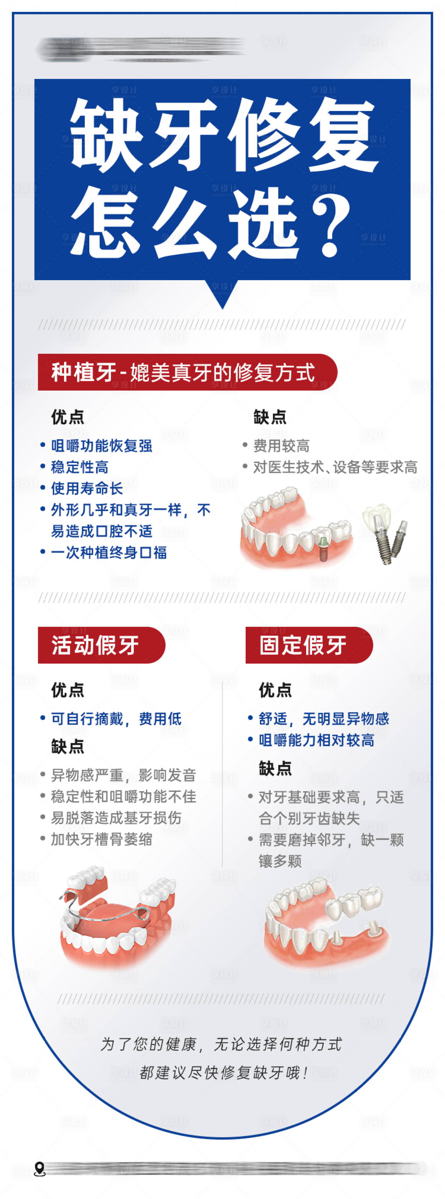 源文件下載【享設(shè)計】搜索編號：49810024425289674【缺牙修復(fù)方式對比海報】