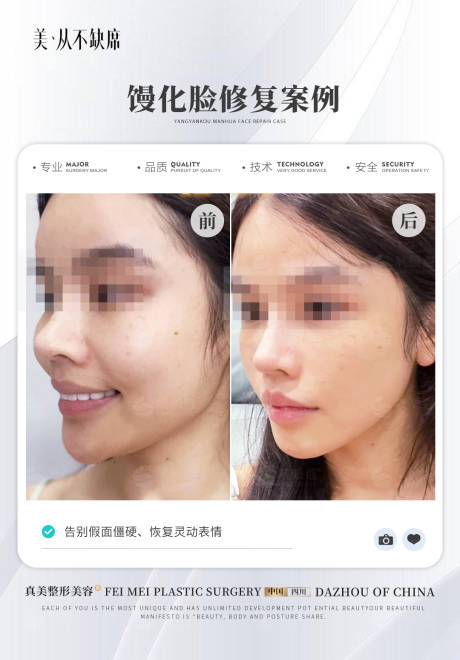 源文件下载【馒化脸案例海报】编号：67420024265433058