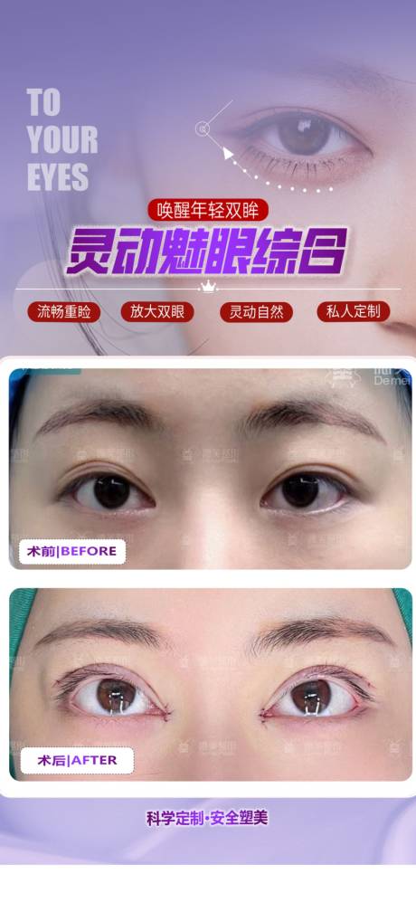 源文件下载【享设计】搜索编号：50430024426622064【眼综合案例海报】
