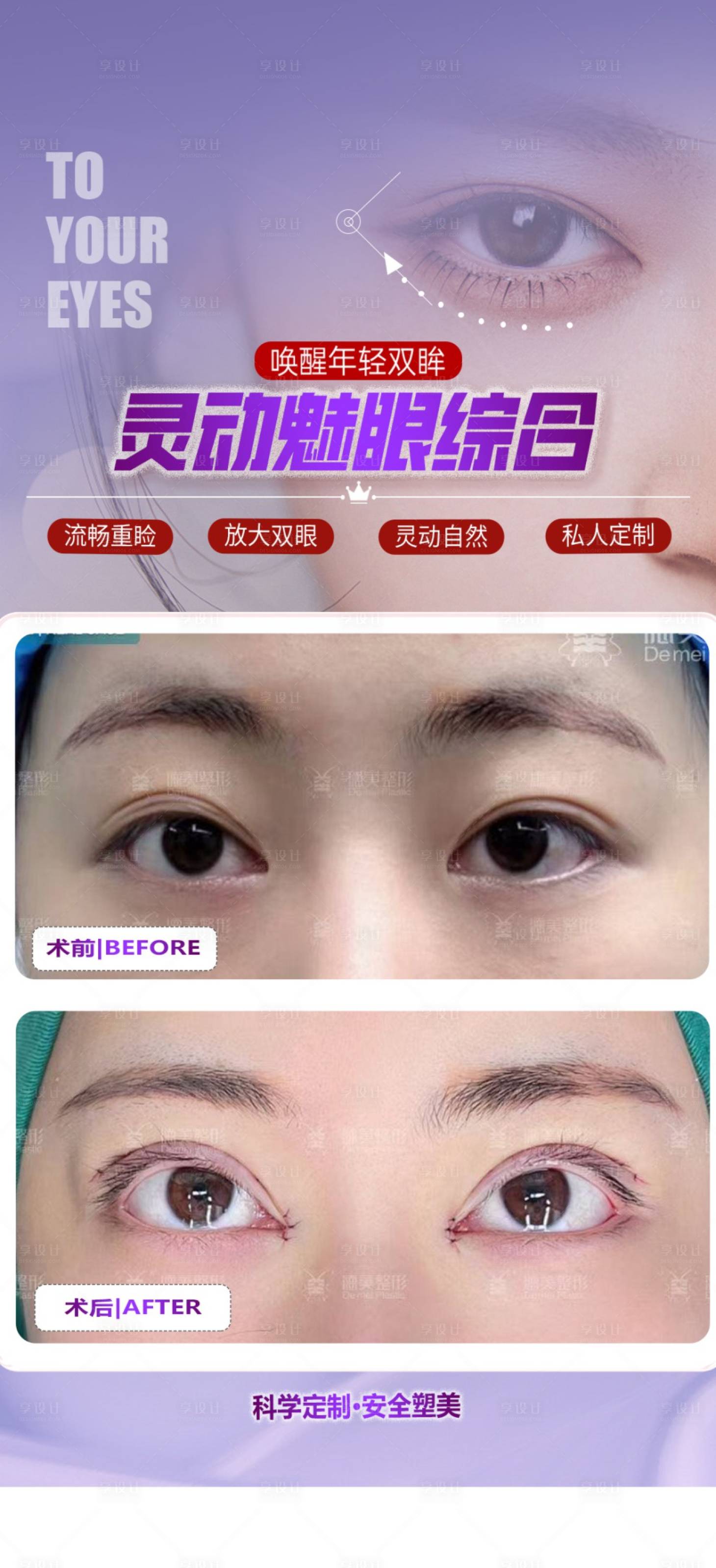 源文件下載【享設計】搜索編號：50430024426622064【眼綜合案例海報】
