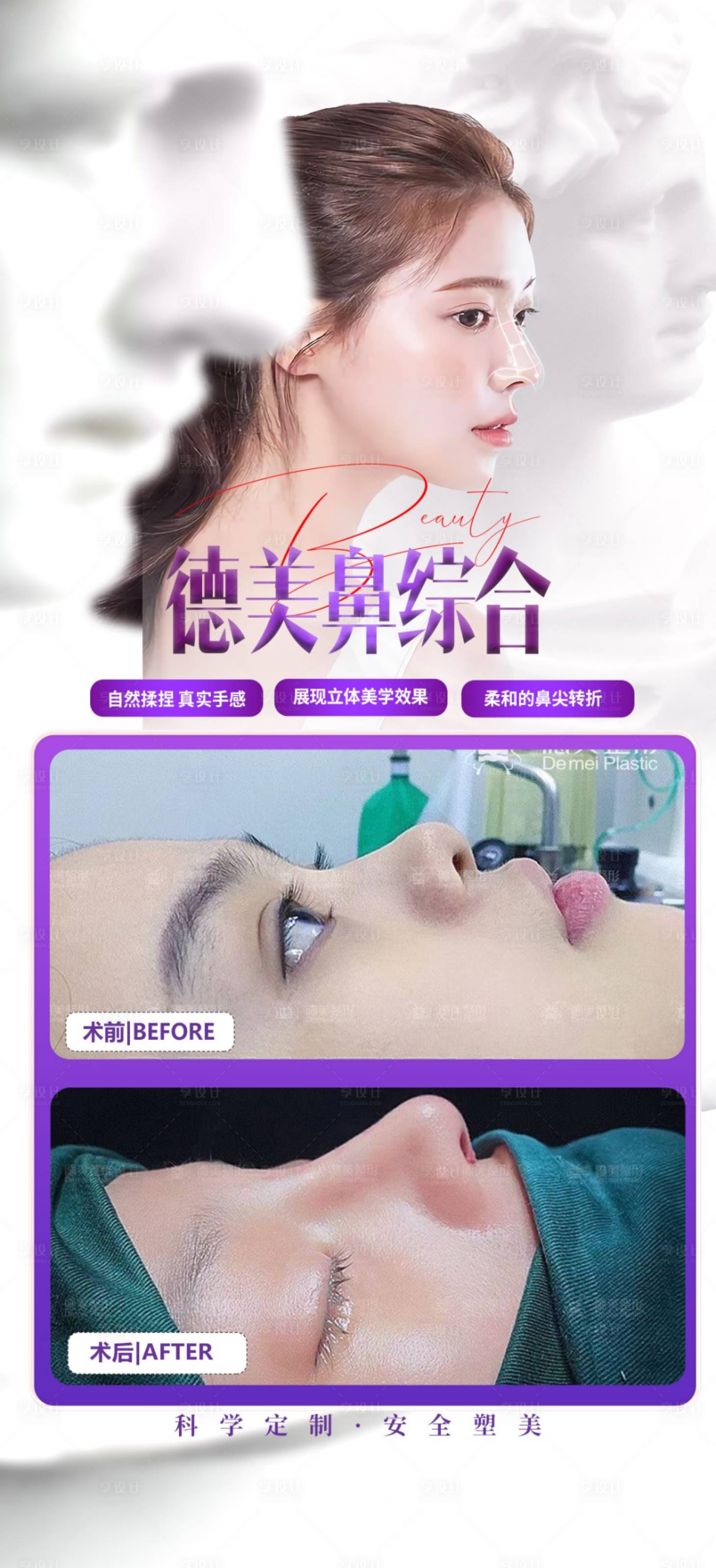 源文件下載【享設計】搜索編號：70670024304113932【鼻綜合案例海報】