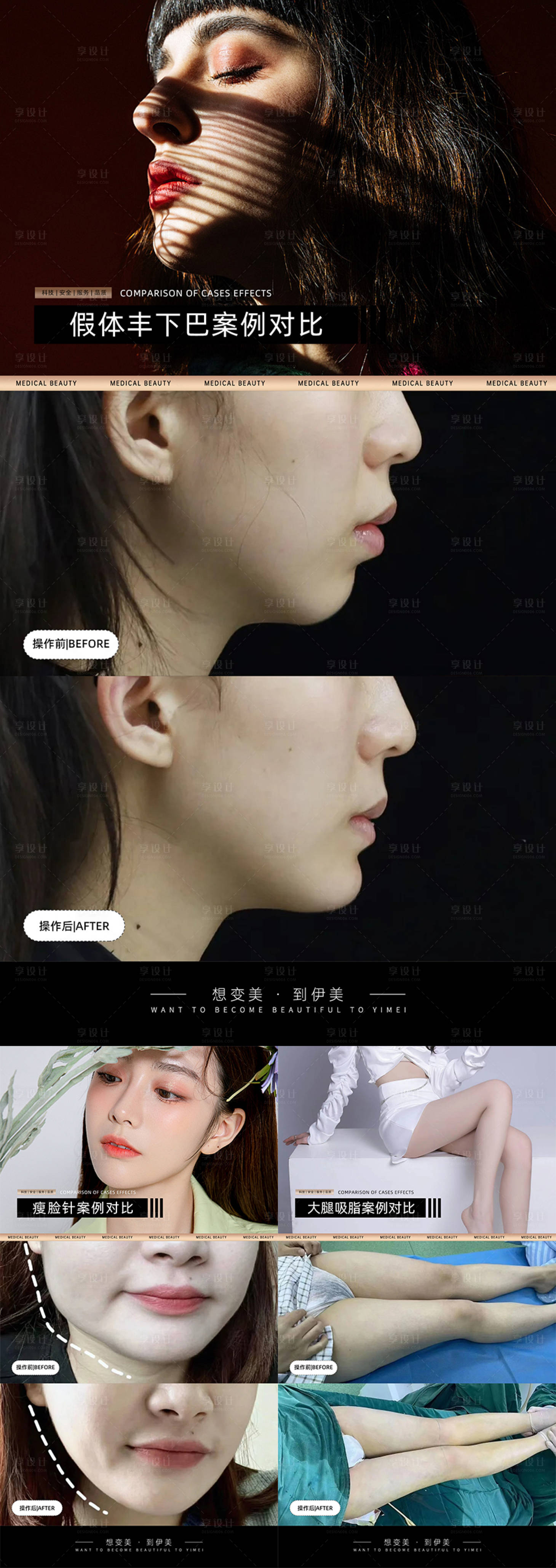 源文件下載【享設(shè)計】搜索編號：41000024266539164【醫(yī)美案例對比模版】