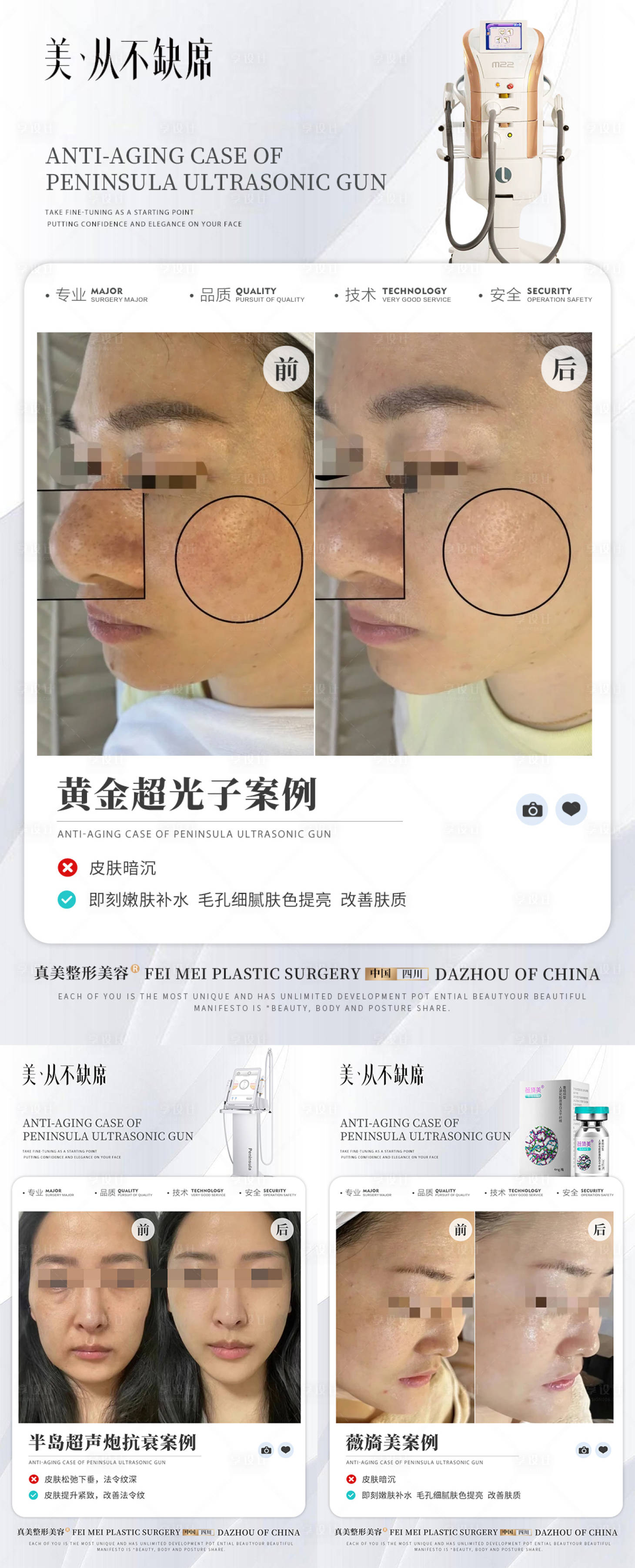 源文件下载【享设计】搜索编号：71960024628724797【医美案例系列】